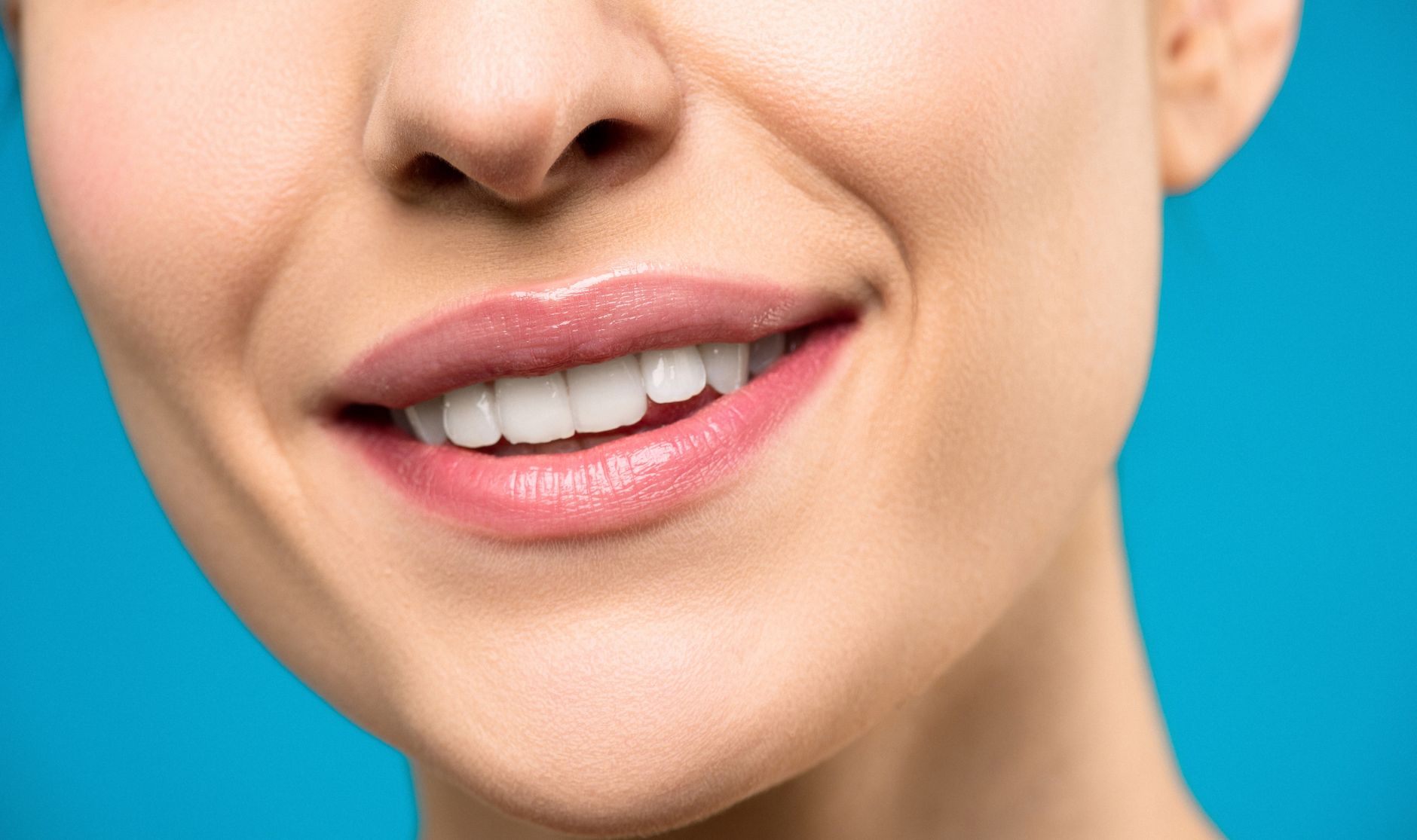 Close-up of a woman smiling, showcasing clear aligners in her mouth.