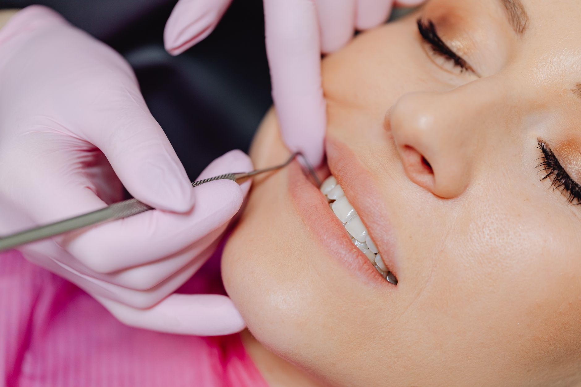 Close-up of a dentist applying composite resin to a patient's teeth for bonding.