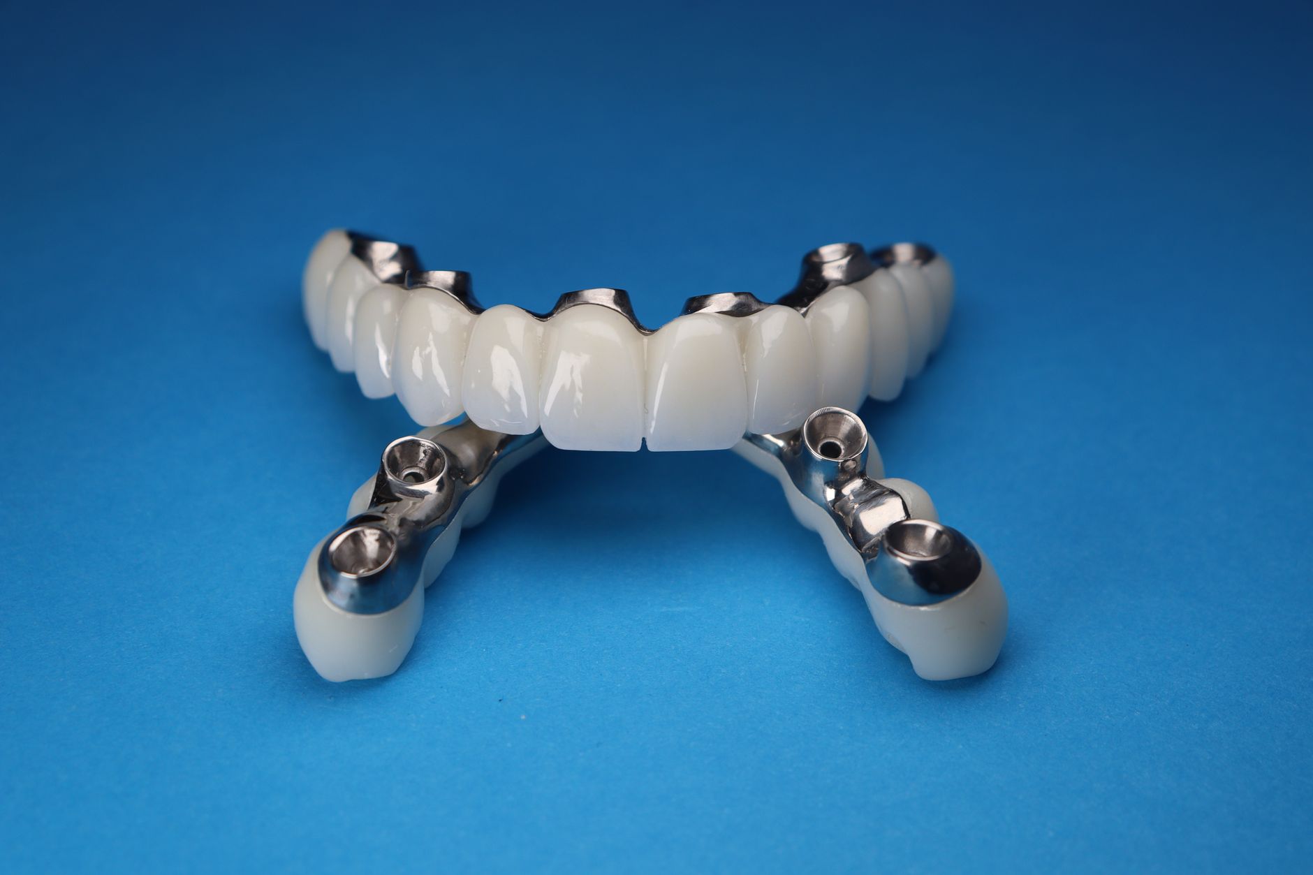 Close-up of a dental implant model displayed for patient consultation.