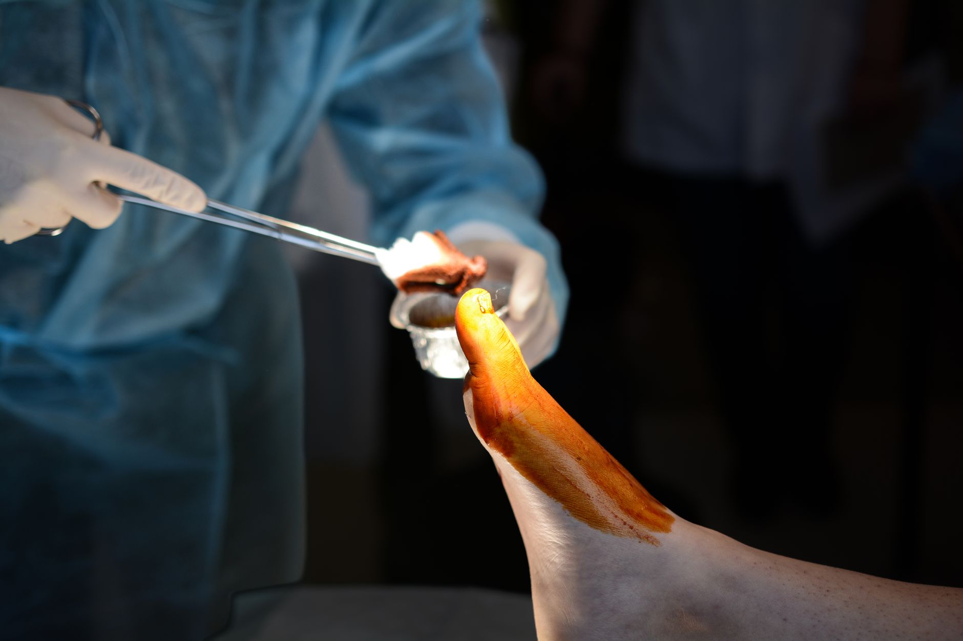 A medical professional in a blue gown prepares a patient's foot for surgery.