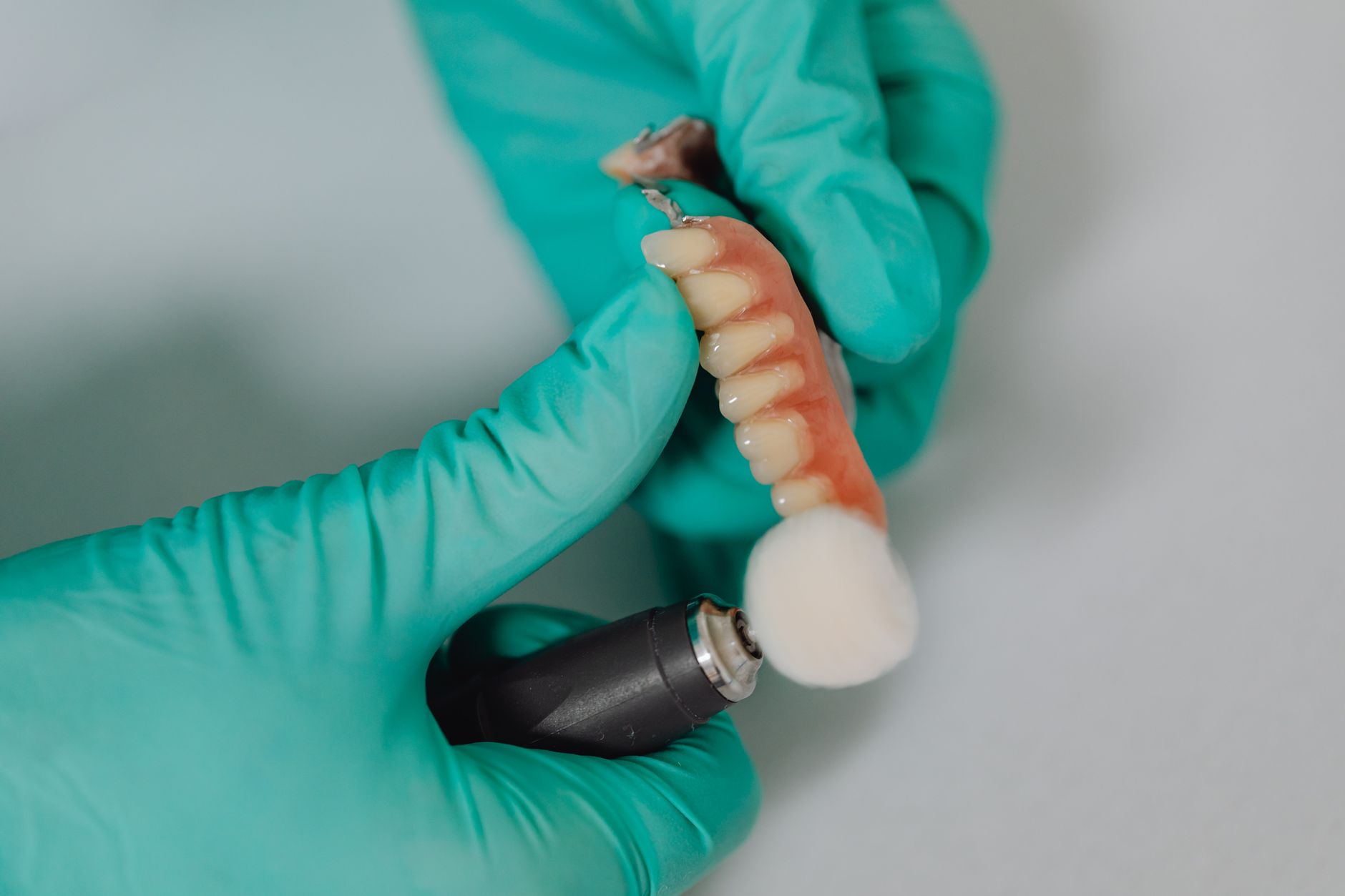 A dentist in green gloves working on a dental implant in a clinic in Antalya.