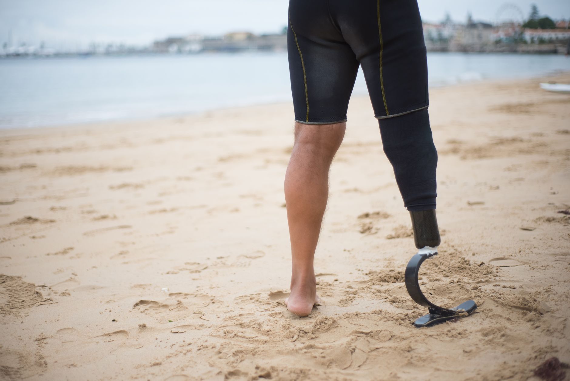 Person walking on the beach in Antalya with a prosthetic leg, enjoying gentle recovery activities.