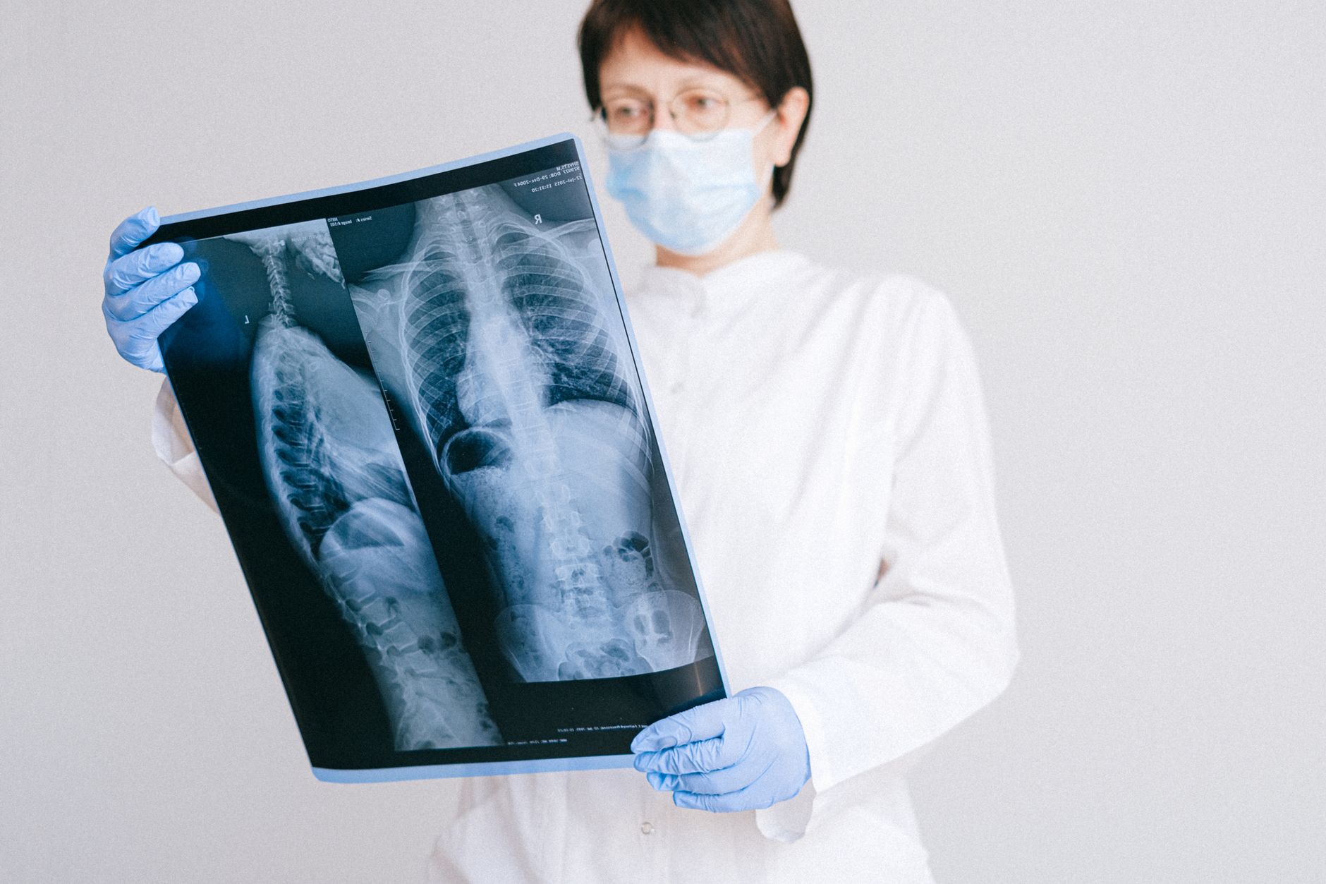 A radiologist in a white coat and gloves examines MRI images in a dimly lit reading room.