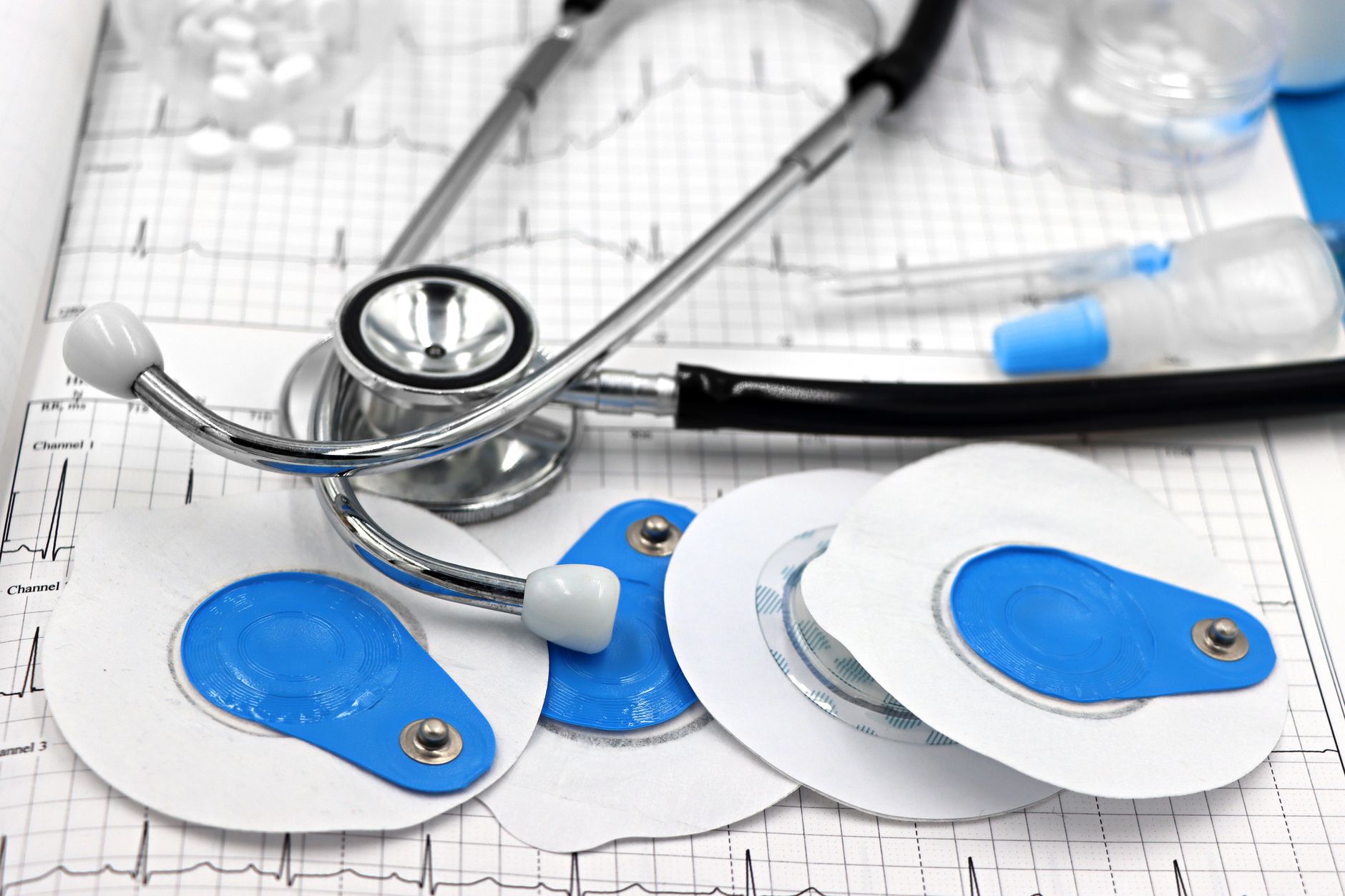 Stethoscope and ECG electrodes on medical graph paper for a stress test.