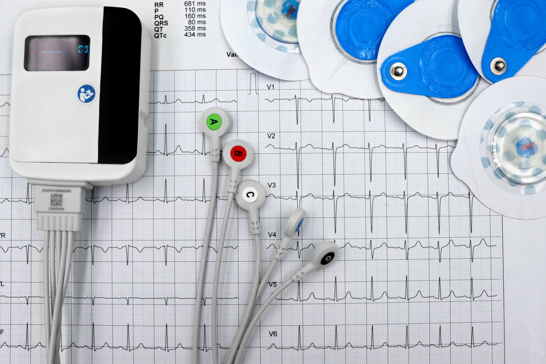 ECG monitor, electrodes, and heart rhythm printout for a patient check-up.