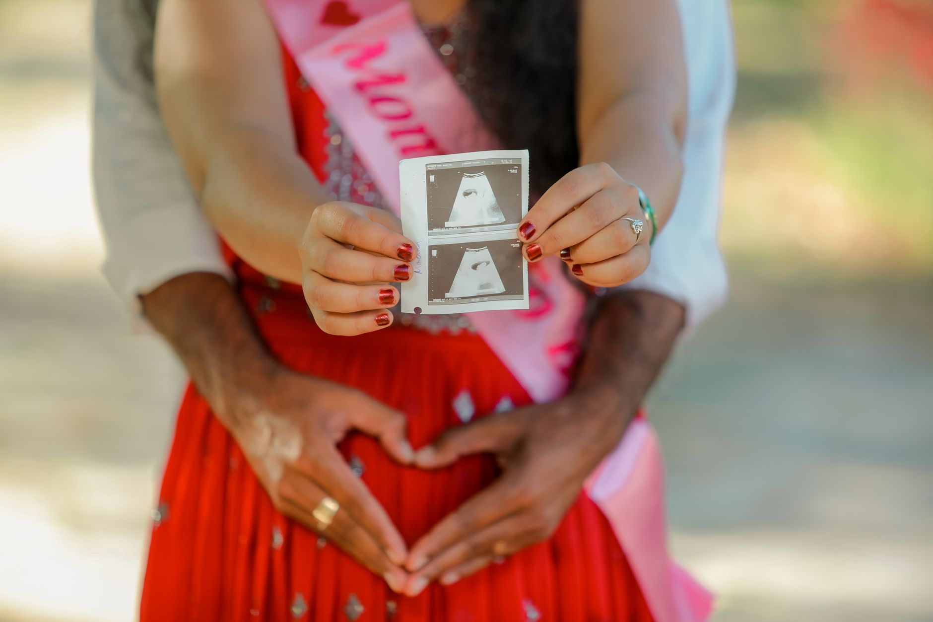 Couple joyfully holding ultrasound images and making a heart shape.