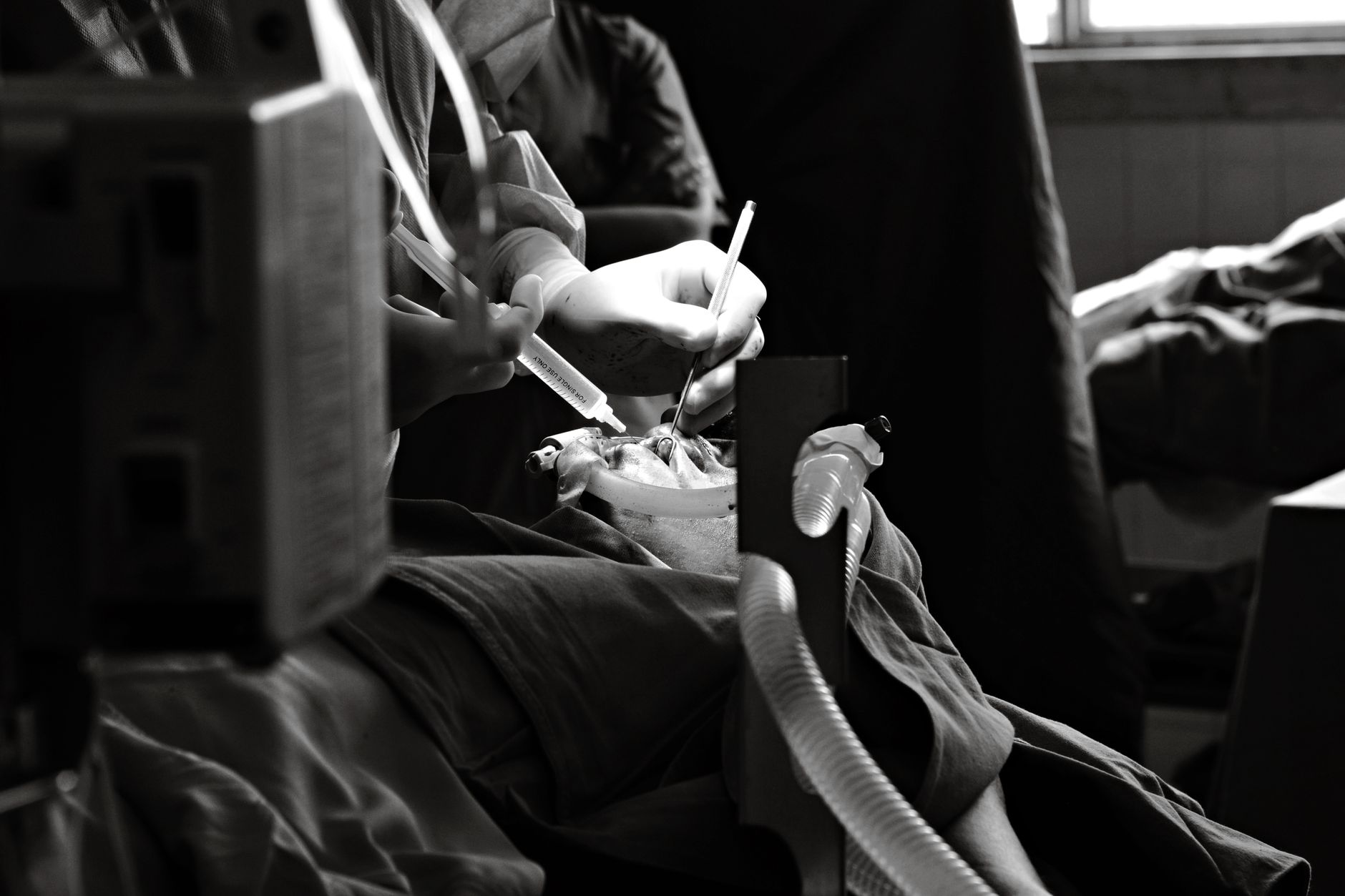 Close-up of a surgeon repairing a baby's cleft lip in a sterile operating room.