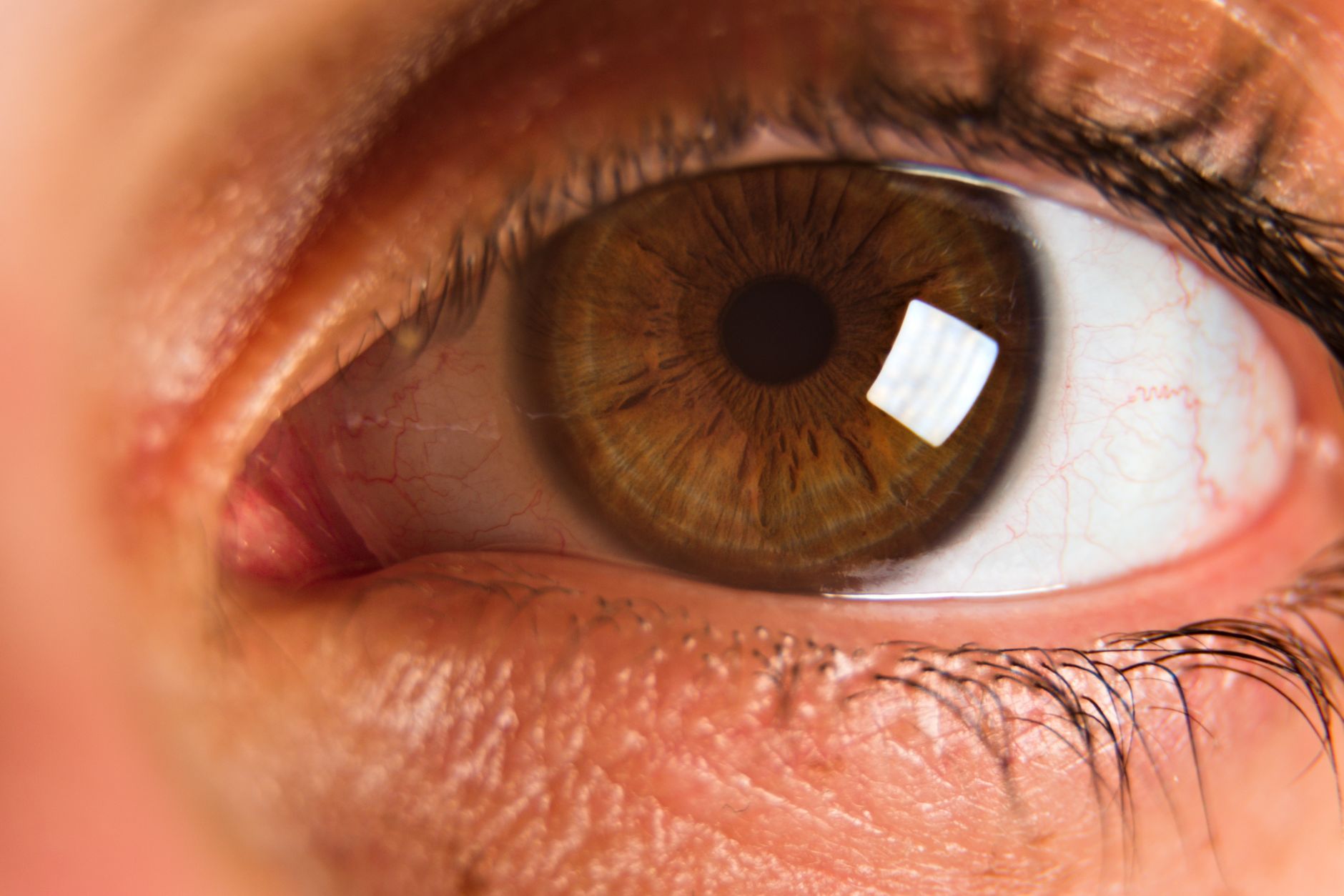 Detailed close-up of a human eye with brown iris, showing texture and reflections.