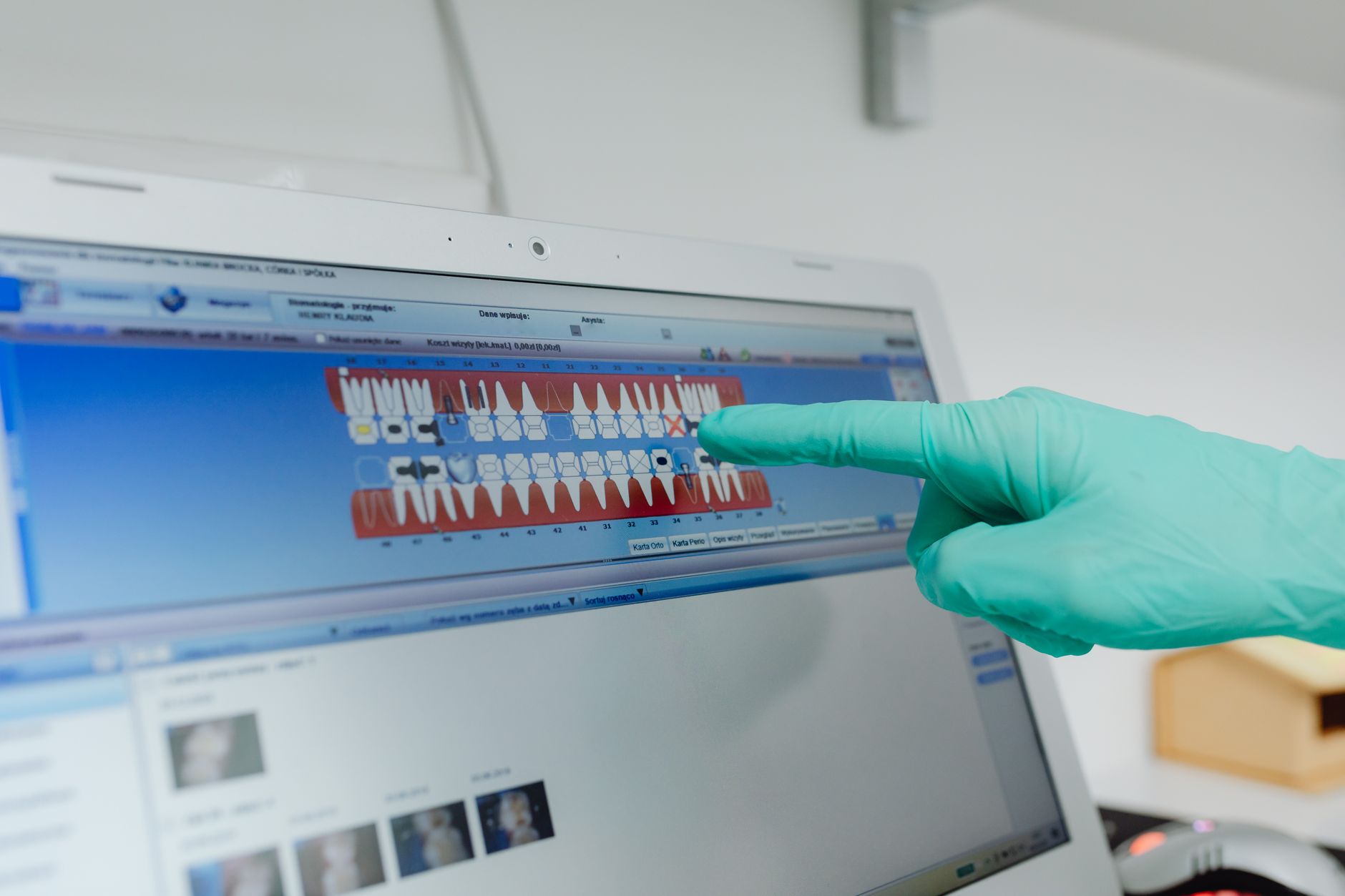 A prosthodontist evaluates a digital smile design on a computer screen.