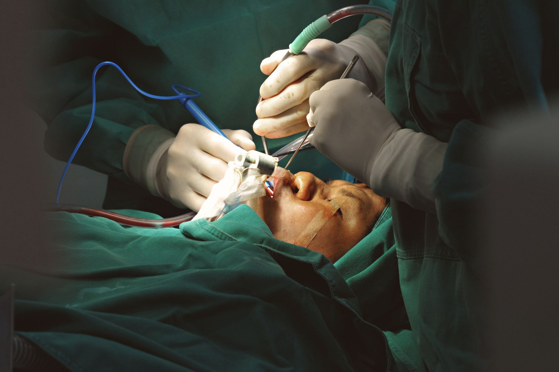 Surgeons performing a body contouring procedure on a patient.