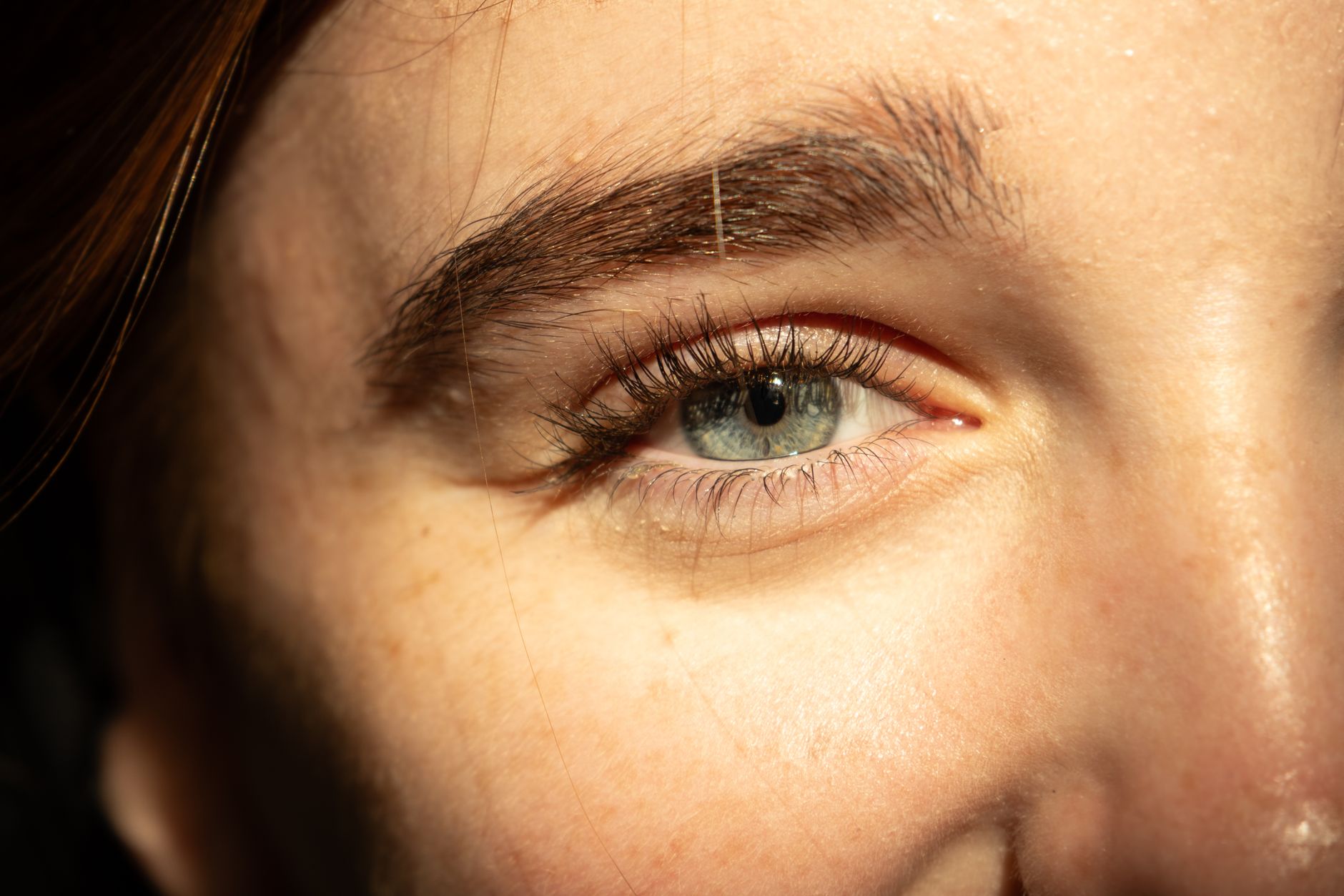 Close-up of a person's eye showcasing a refreshed gaze post eyelid surgery.
