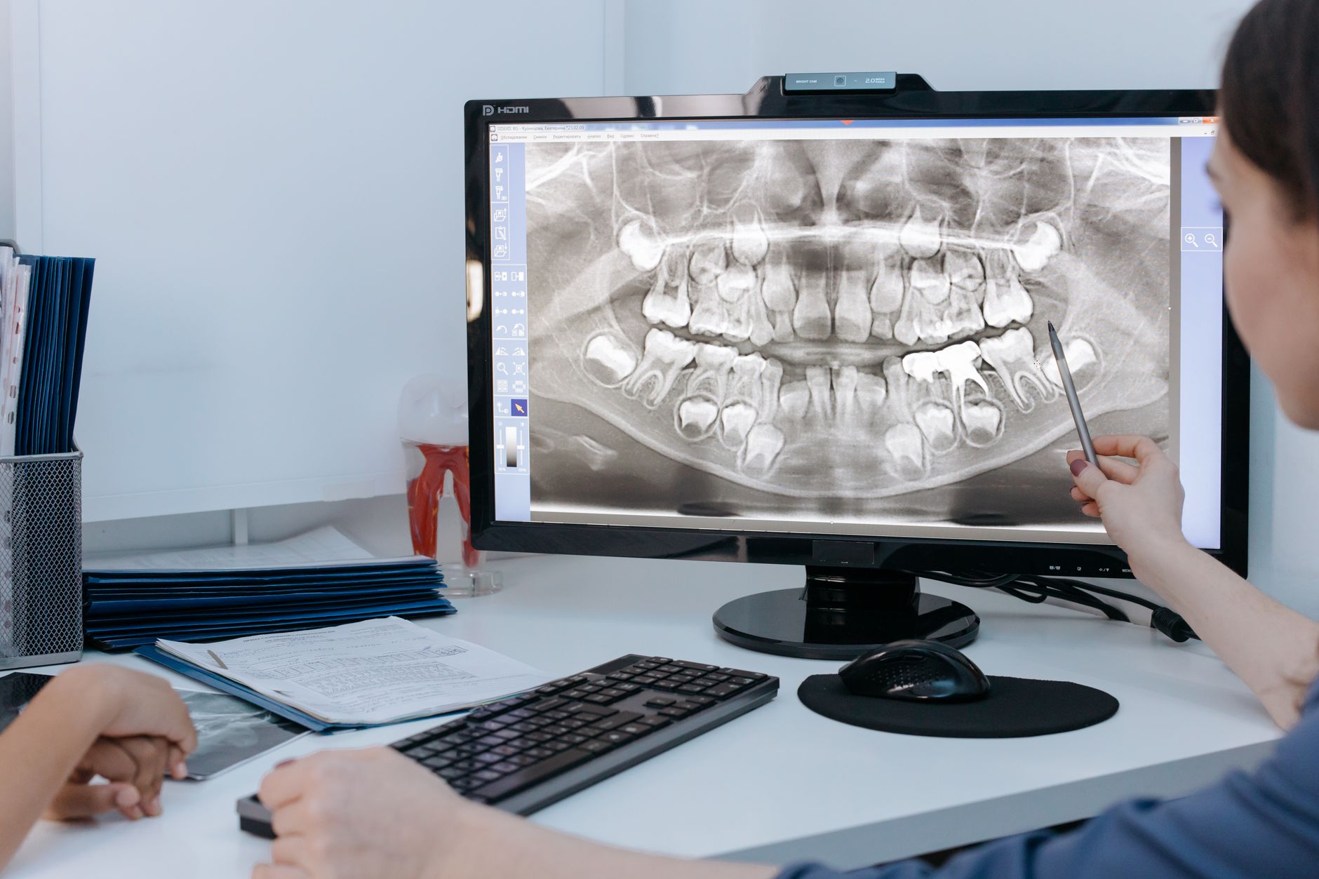 A dentist examines digital dental X-rays on a screen during a consultation.