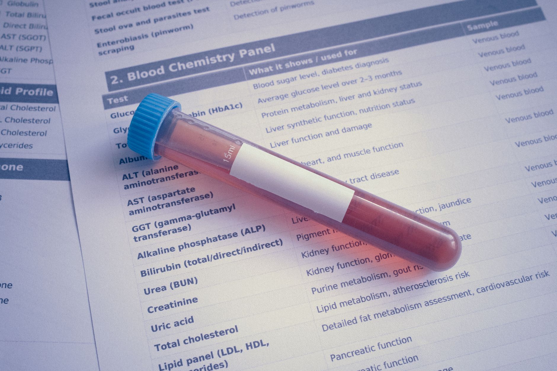 Blood test vial on a blood chemistry panel document in a laboratory setting.