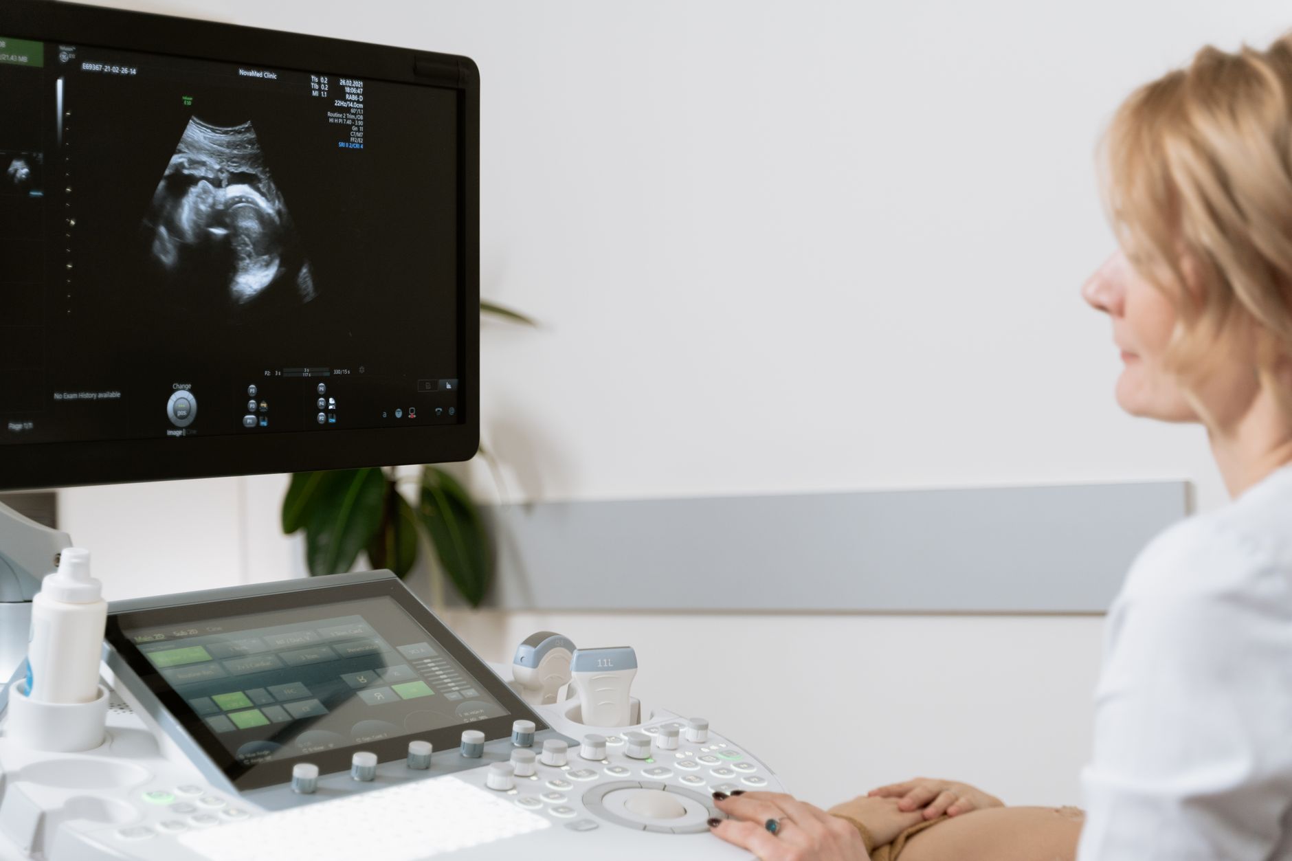 A healthcare professional observing an ultrasound scan on a monitor in a medical clinic.