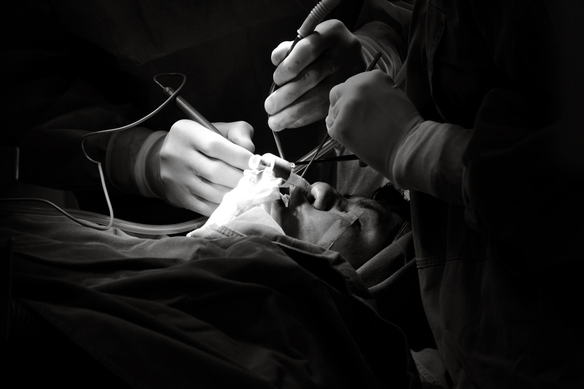 Close-up view of a LASIK procedure using a femtosecond laser for eye surgery.