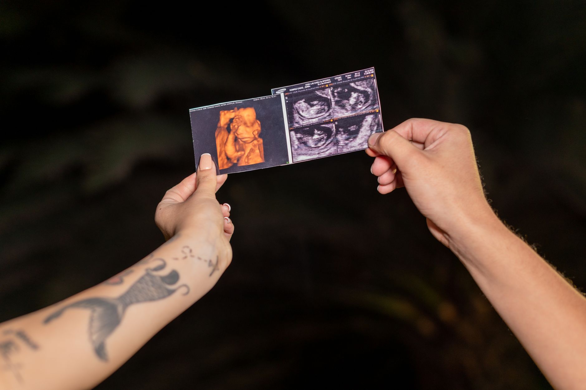 A couple joyfully holding ultrasound photos, celebrating a successful fertility treatment.