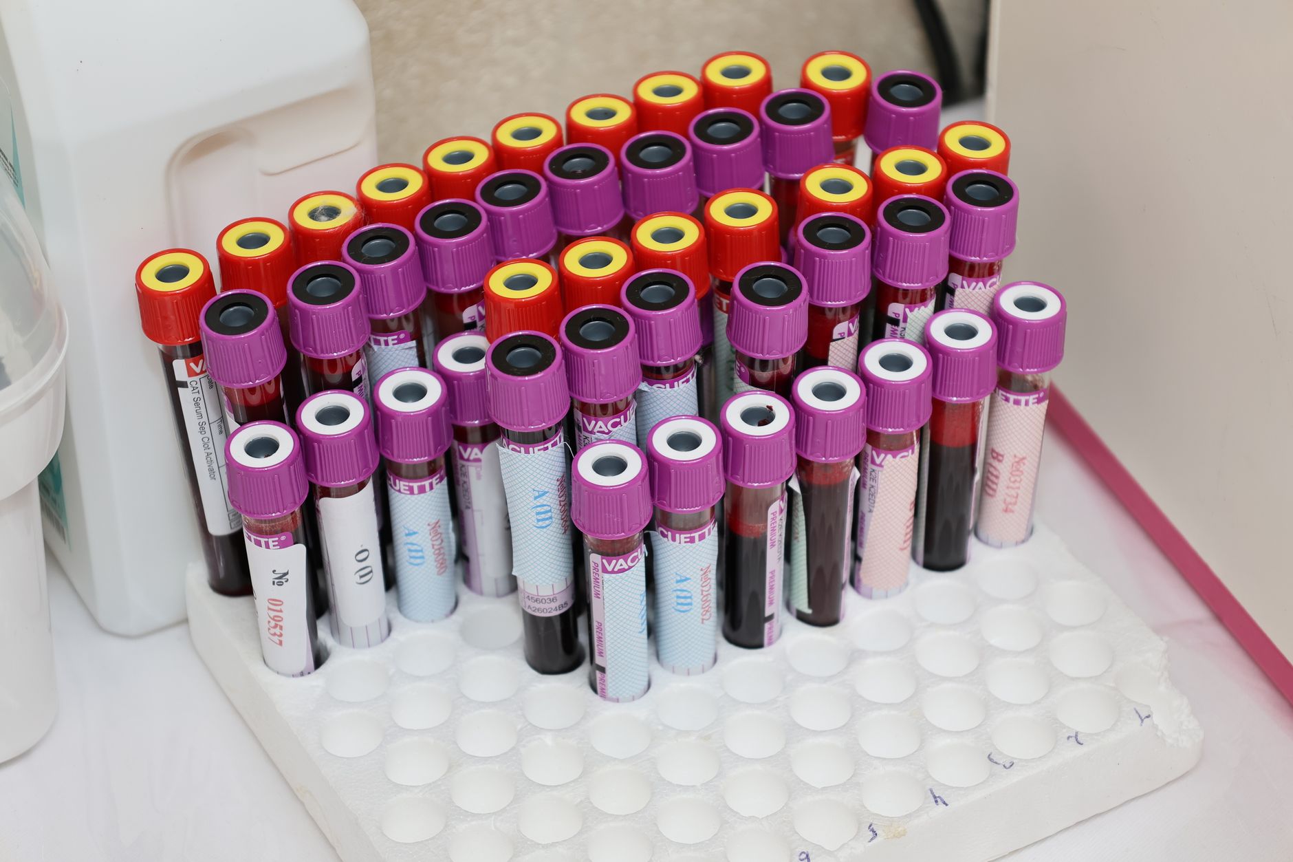 A collection of blood sample tubes organized in a laboratory tray, showcasing various colored caps.