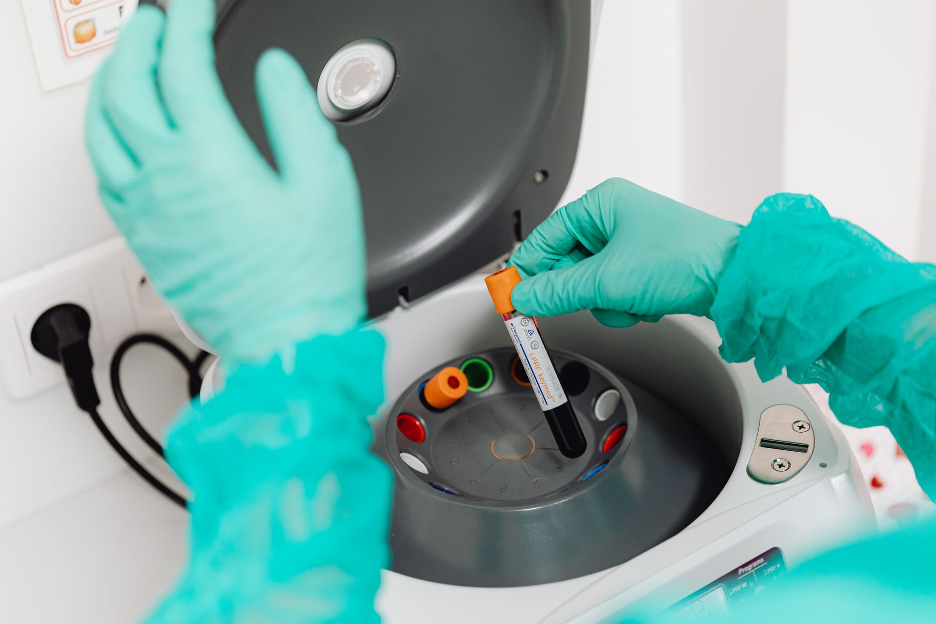 Healthcare professional placing a blood sample into a centrifuge for testing.