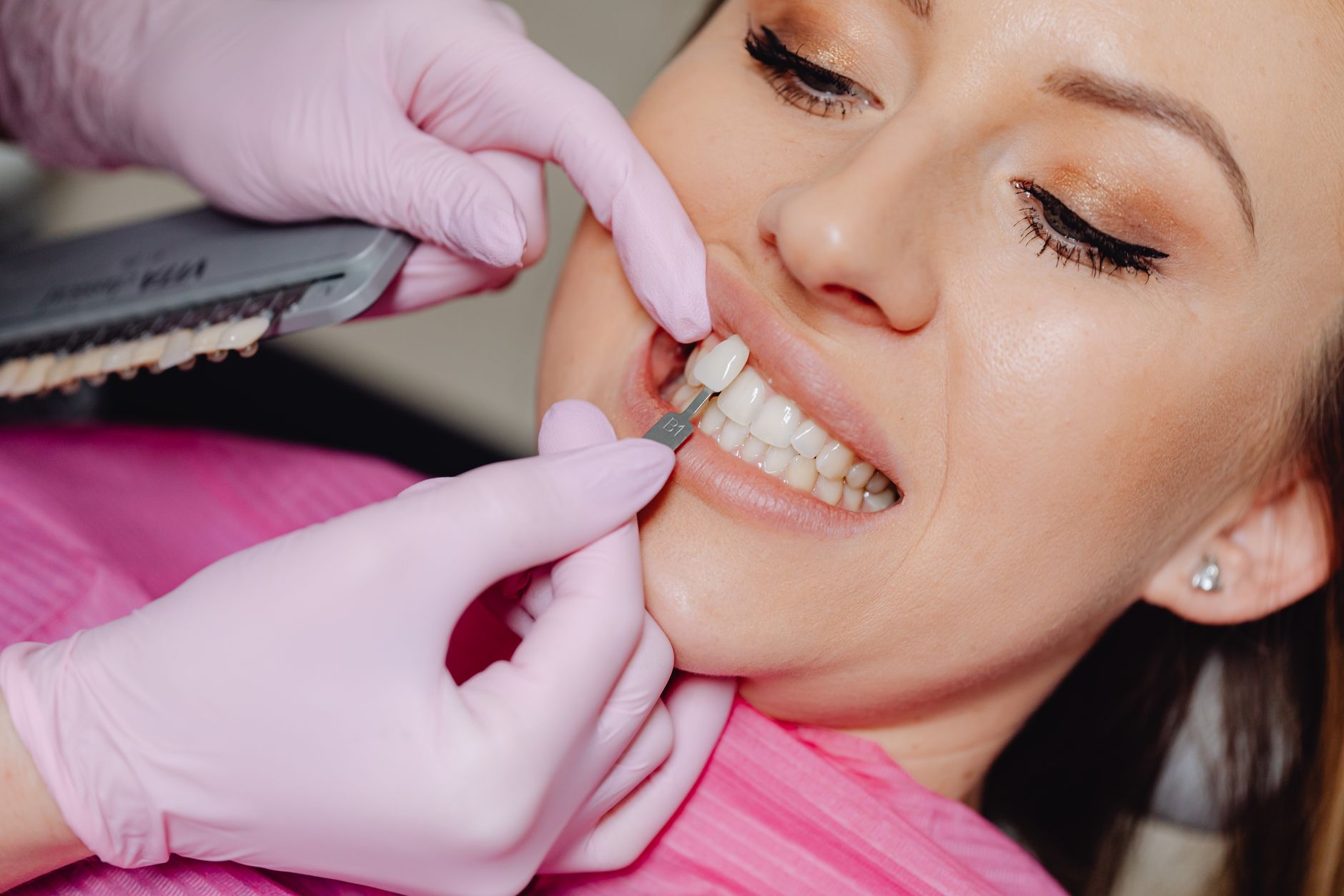 Patient being fitted for veneers at a dental clinic, smiling with healthy teeth.