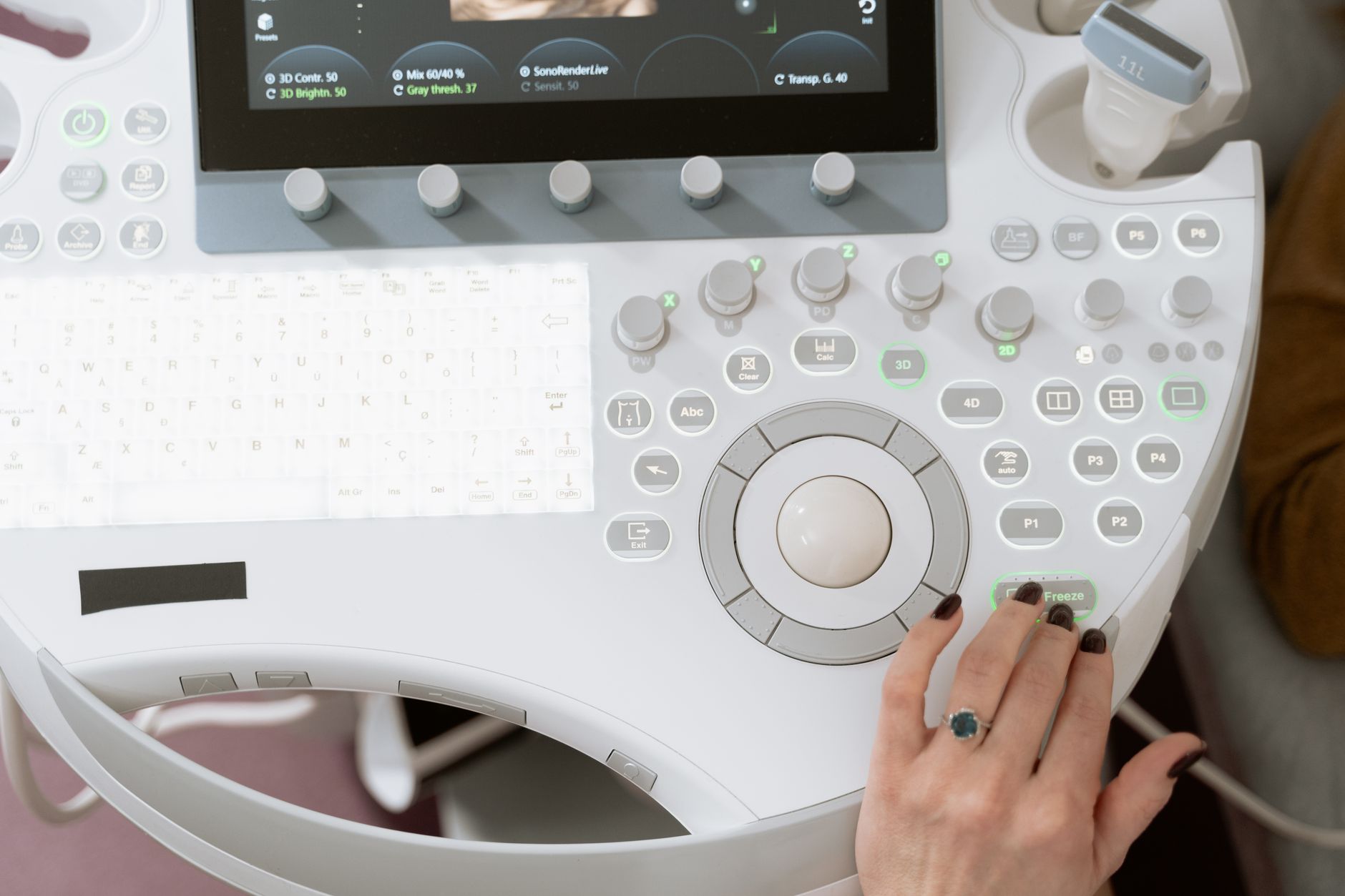 Close-up of an ultrasound machine as a woman undergoes an IVF scan.
