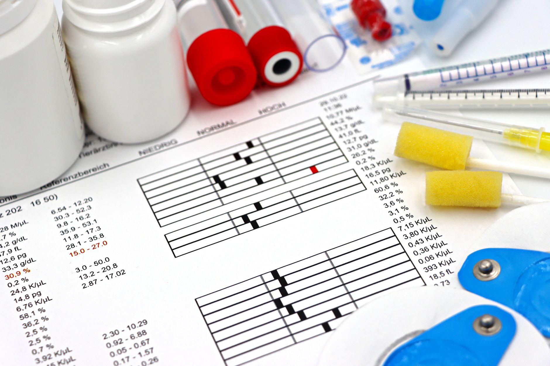 Medical supplies and test results related to kidney transplant analysis.