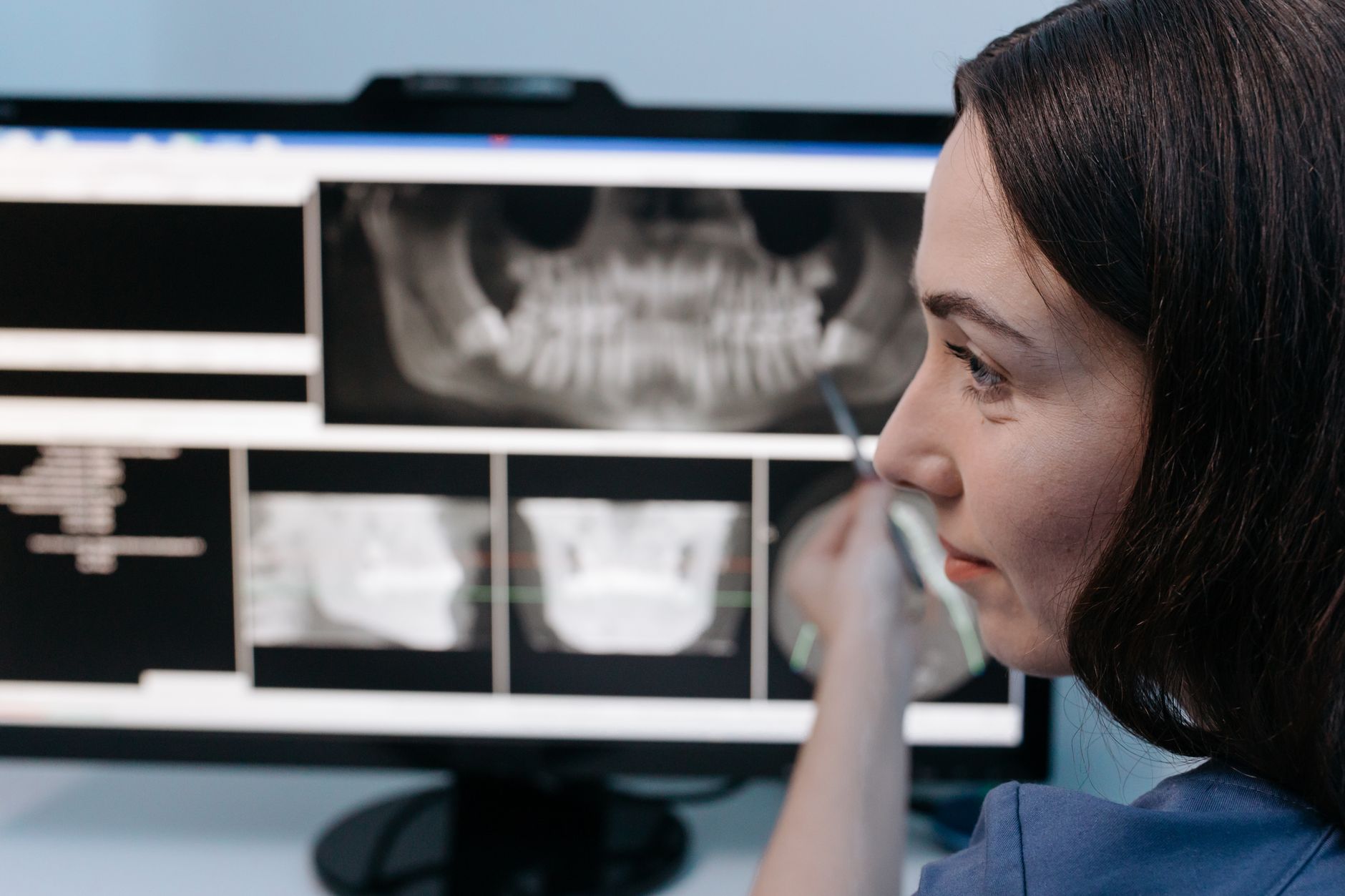 A healthcare professional examines knee X-rays on a computer screen.
