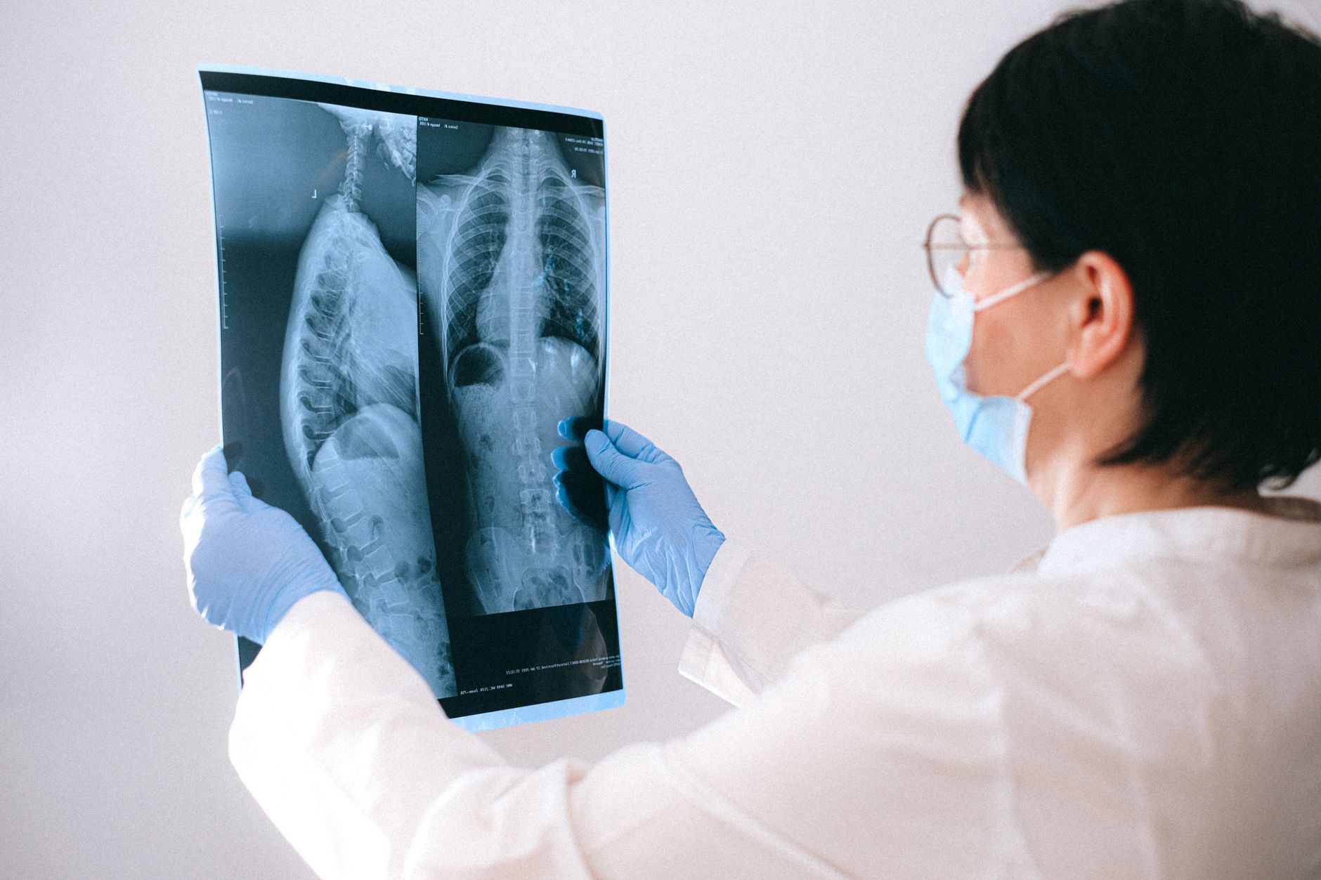 A surgeon analyzes X-ray images for pre-operative planning while wearing gloves and a mask.