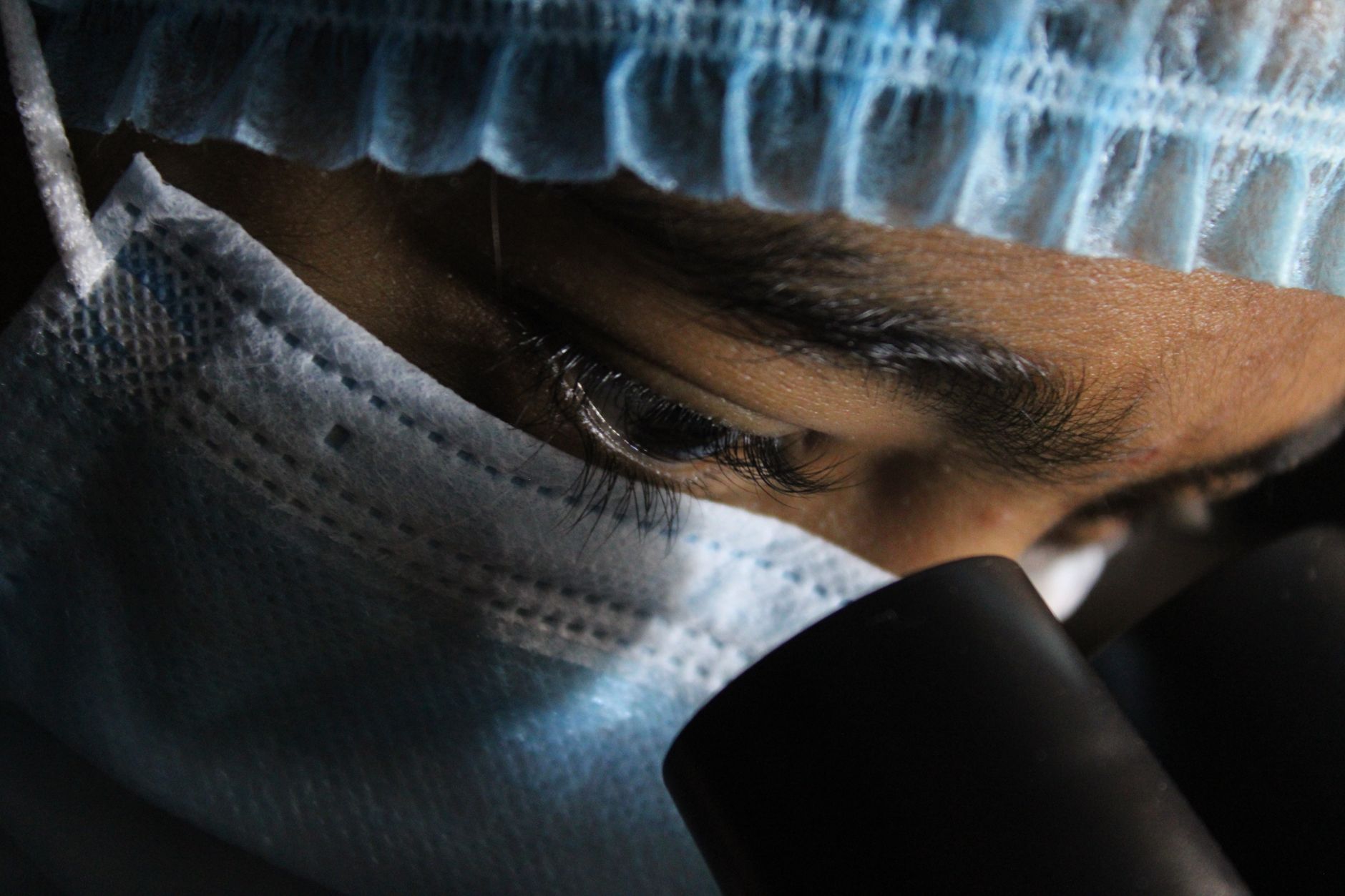 Close-up of a surgeon examining a patient through a microscope during a SMILE procedure.