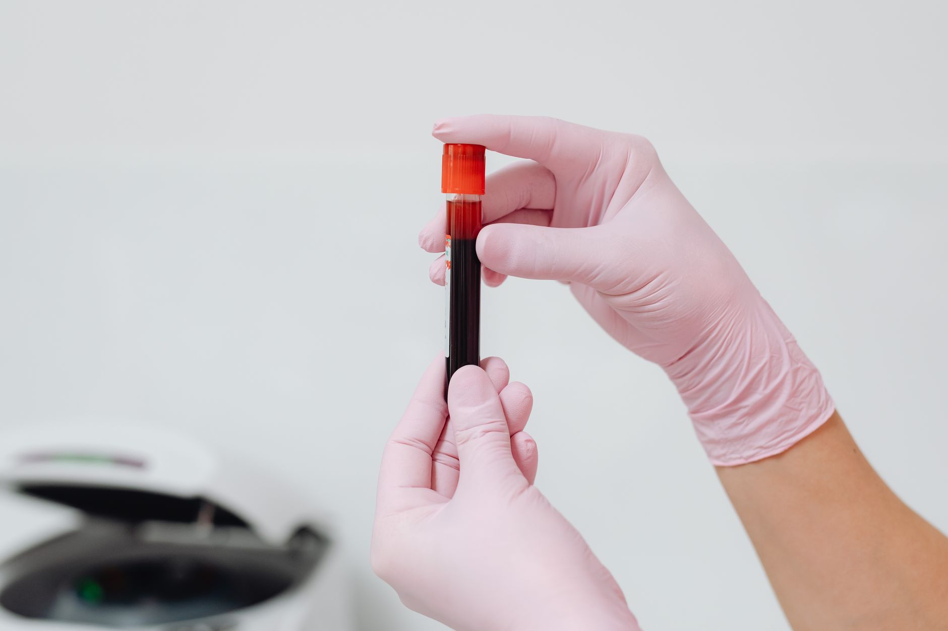 A technician in pink gloves holds a blood sample tube in a lab.