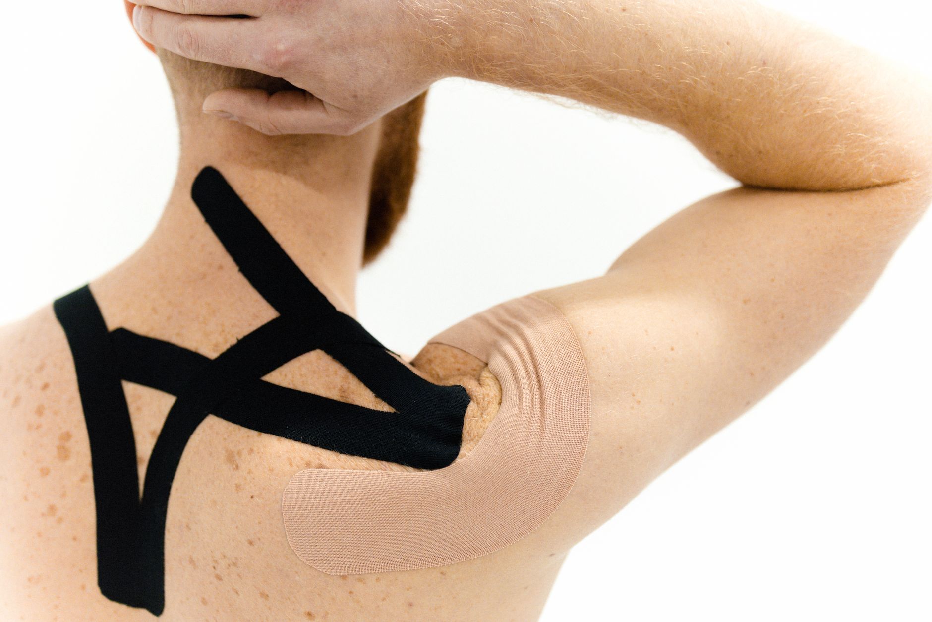 A patient receives shoulder rehabilitation with kinesiology tape applied on their back and arm.