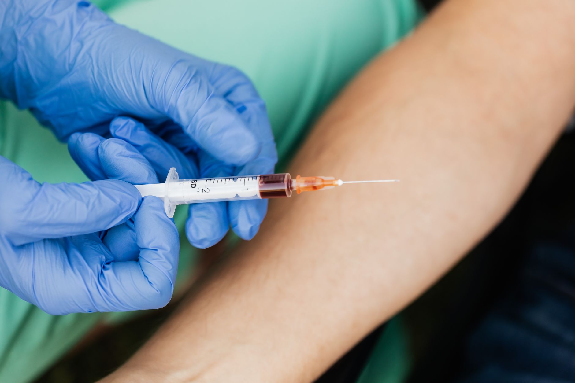 A medical professional in blue gloves prepares a syringe for sclerotherapy on a patient's arm.