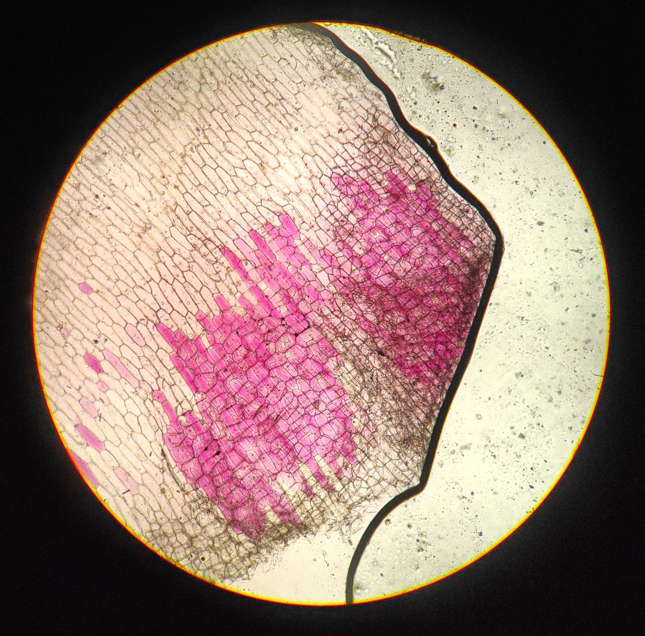 Close-up view of a tissue sample under a microscope, showing pink-stained histological features.
