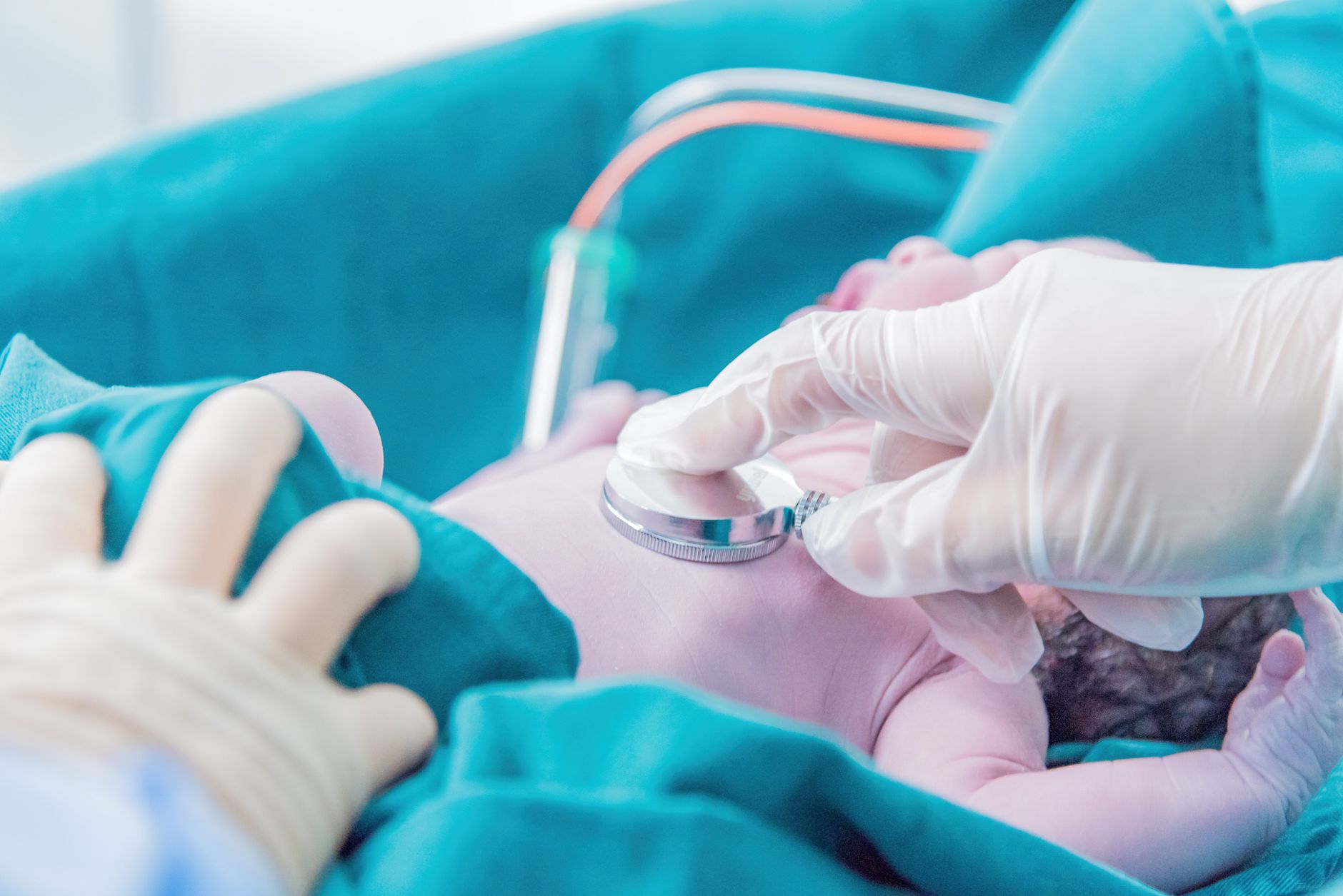 A pediatrician examines a newborn with a stethoscope in a NICU.