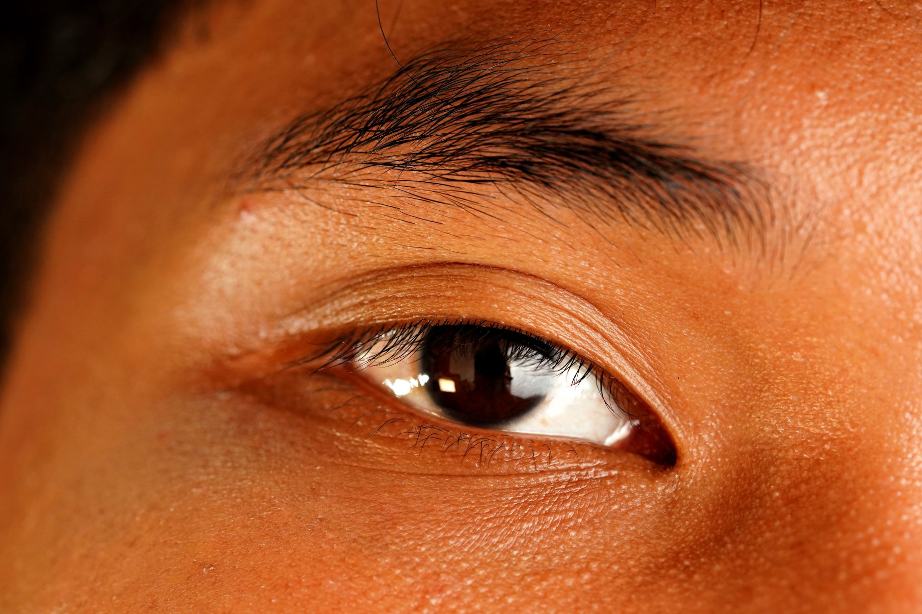 A close-up view of a brown eye, showcasing the delicate eyelid structure for reconstruction.