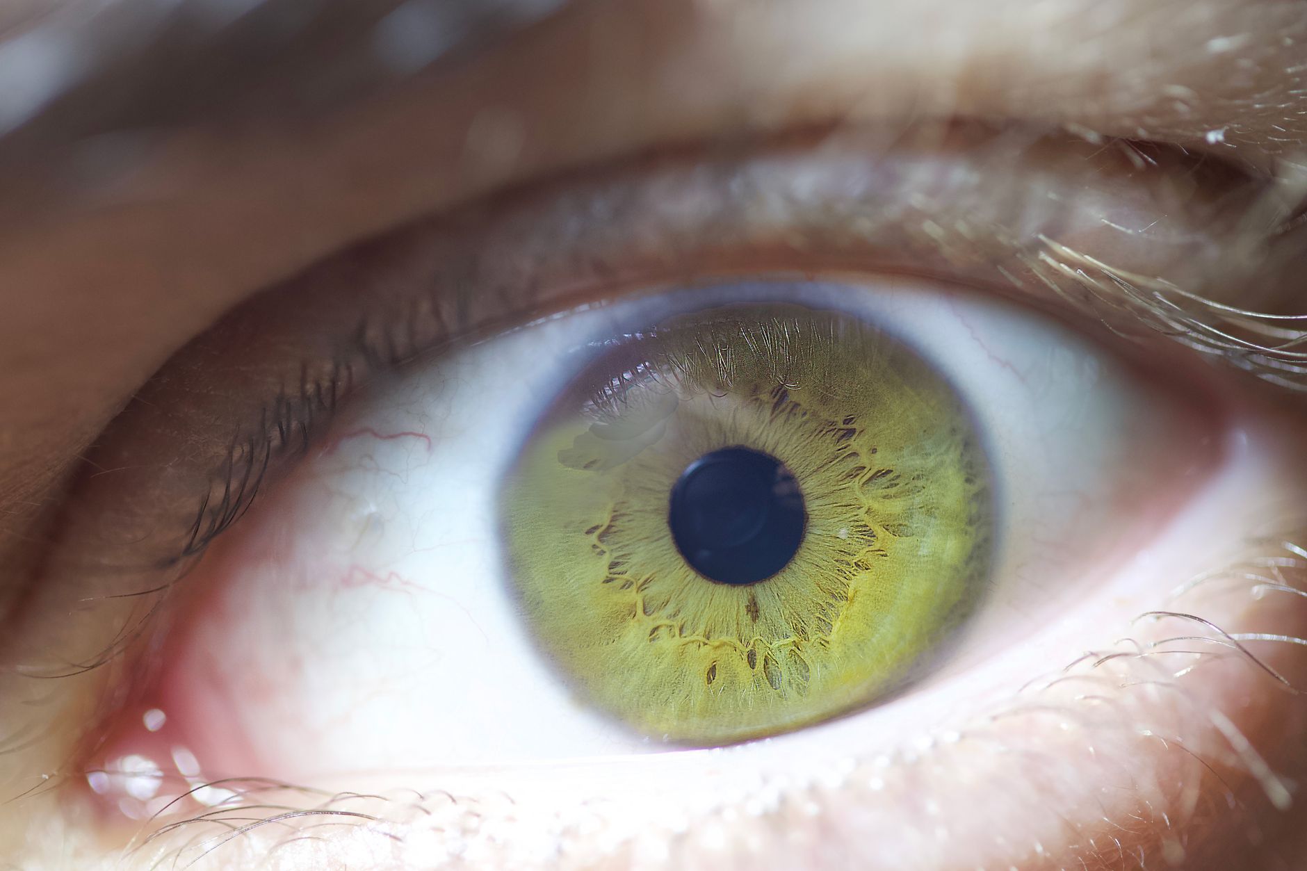 Close-up view of a green eye showing intricate details from retinal imaging.