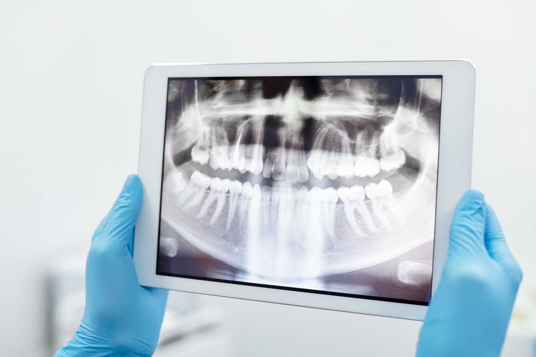 Dental professional holding a digital X-ray image on a tablet for orthodontic assessment.