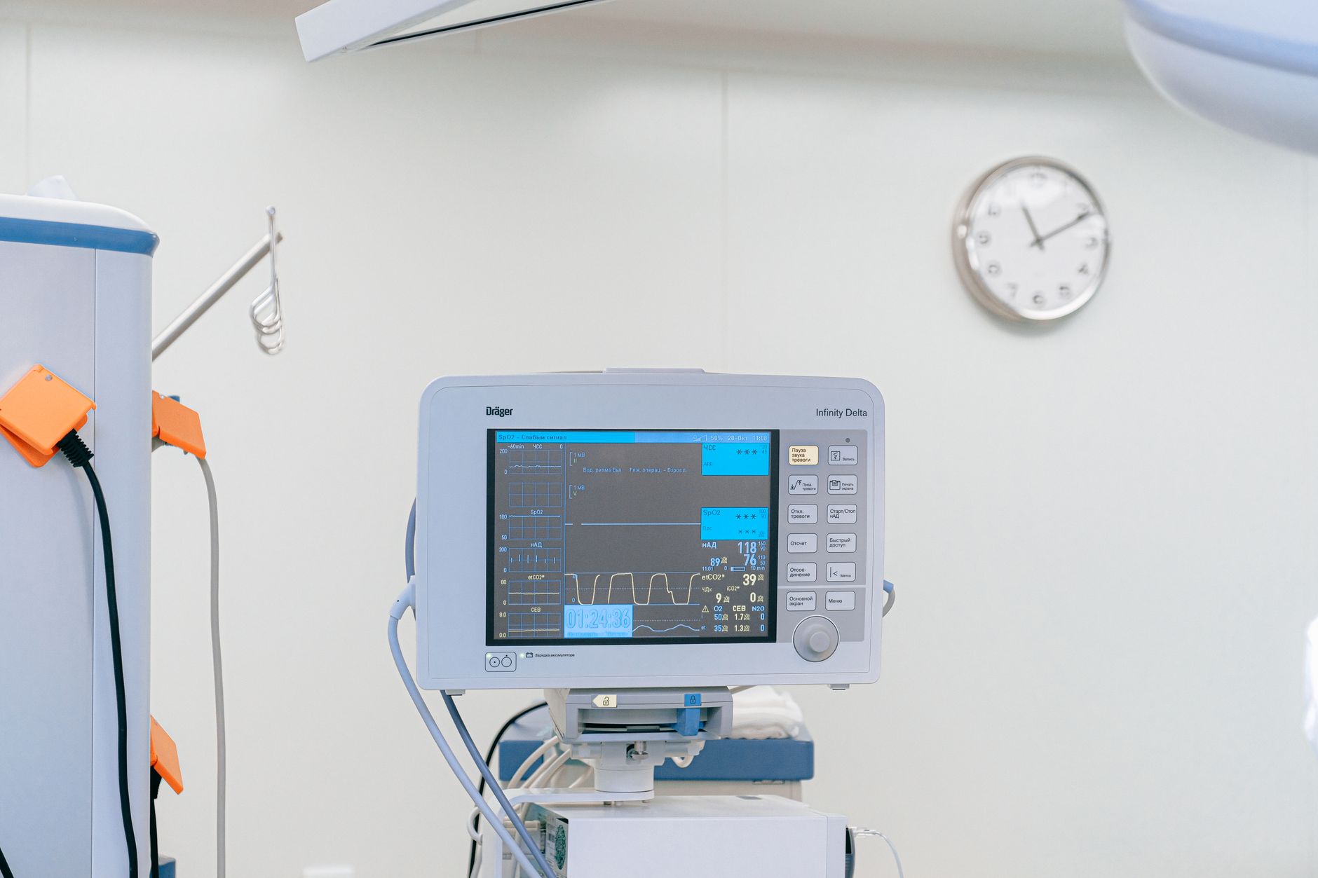 A medical monitor showcasing vital signs in a sterile operating room.