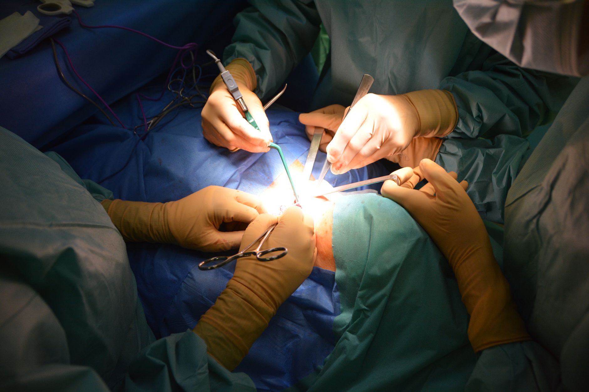 A team of paediatric cardiac surgeons conducting surgery on a child's heart.