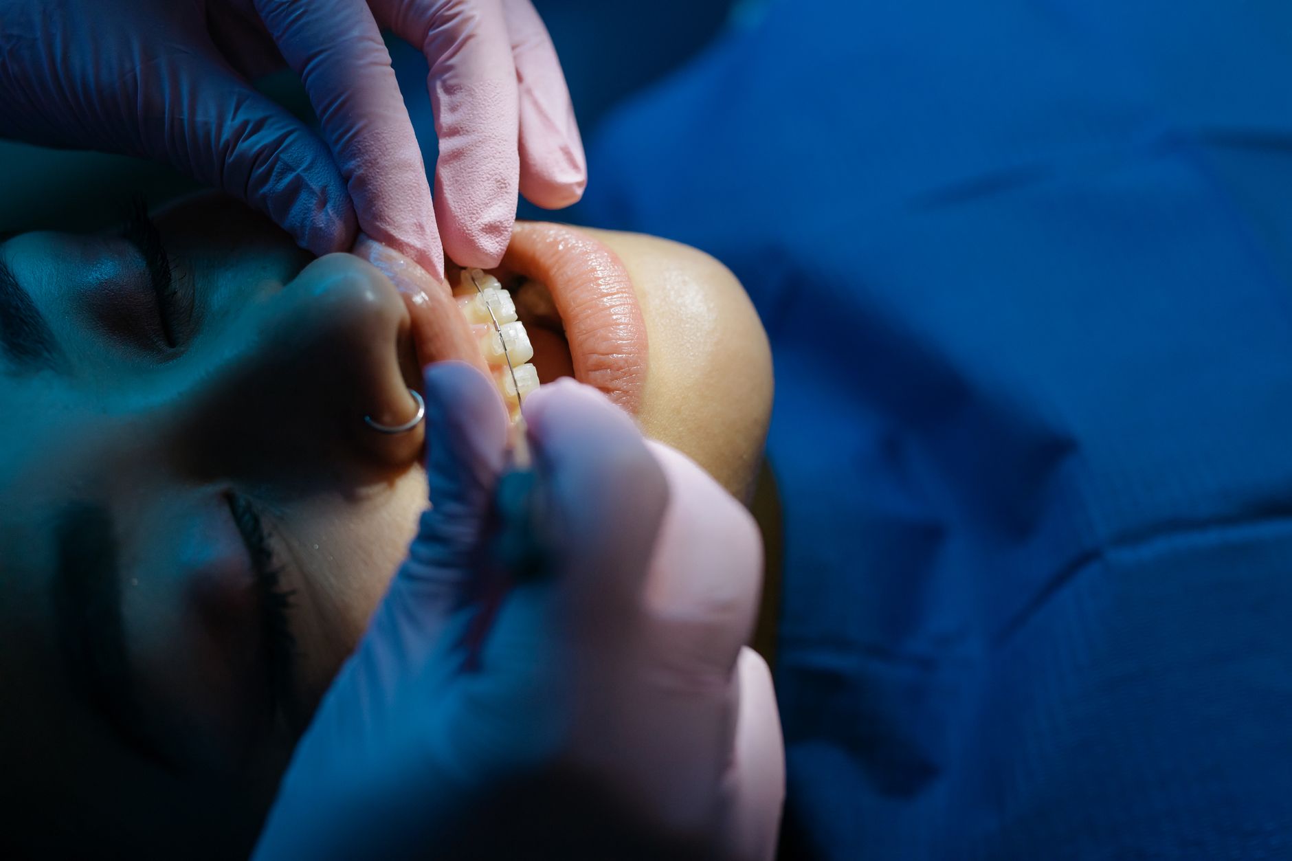 A dentist adjusts braces on a patient in a bright orthodontic clinic.
