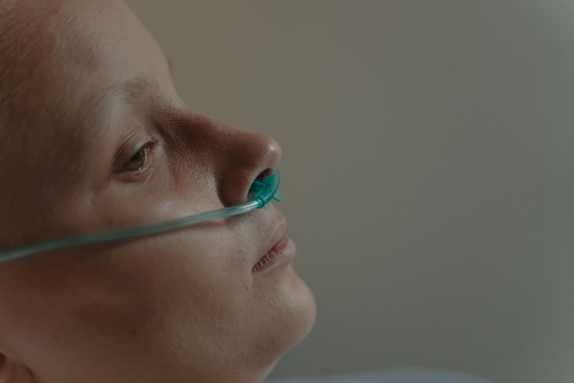 A close-up image of a patient receiving oxygen through a tube in a clinical setting.