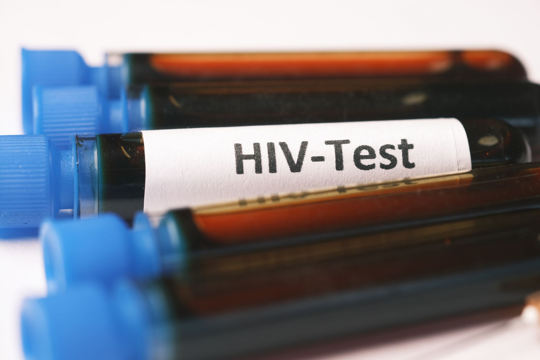 Close-up of blood test tubes labeled for HIV testing in a lab setting.