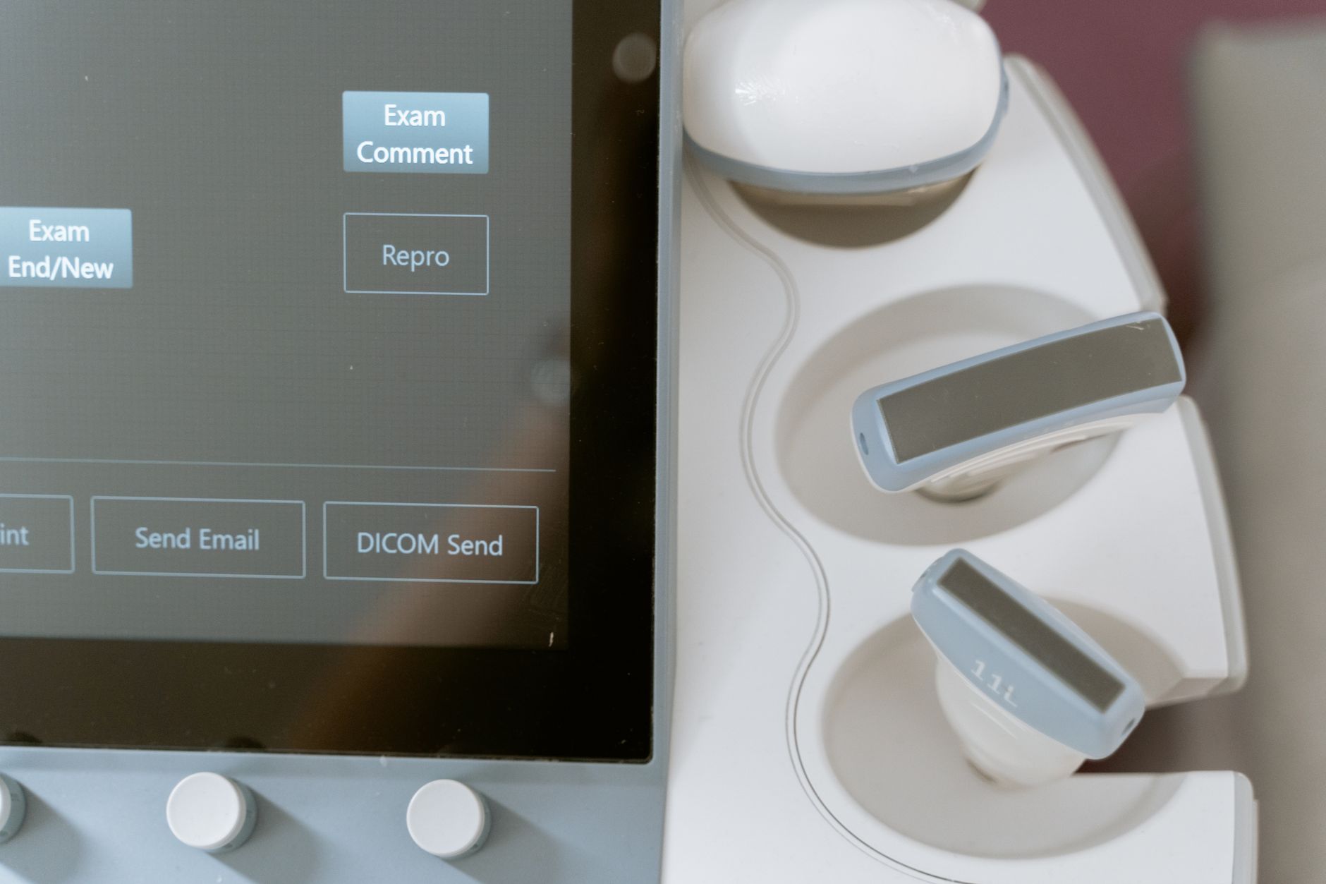 Close-up of a touchscreen interface on a medical device for surgical planning.
