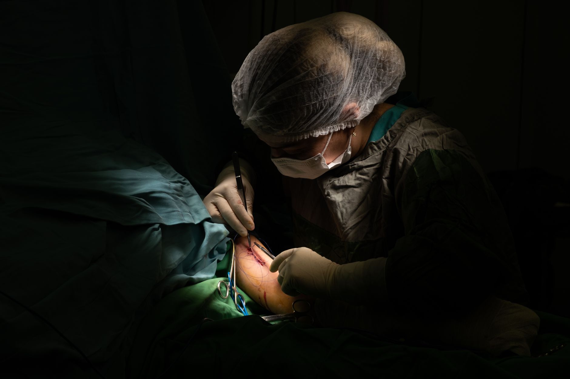 A close-up of a surgeon skillfully suturing a patient in an operating room.