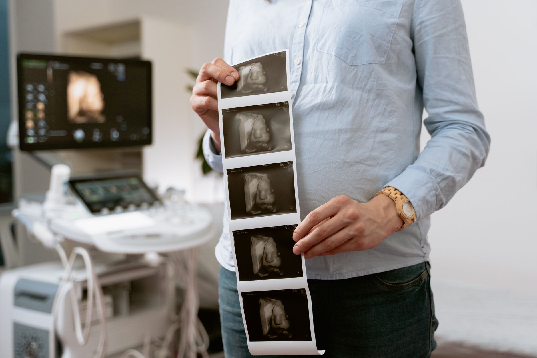 Person holding ultrasound images showing uterine fibroids during a medical examination.