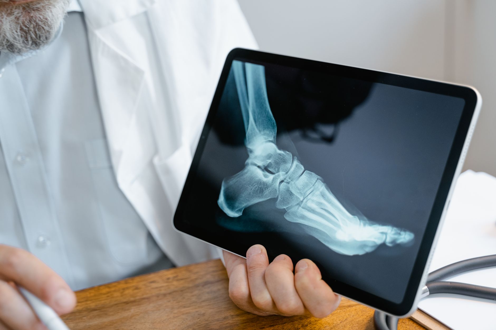 Orthopedic surgeon shows X-ray of foot to international patient in clinic.