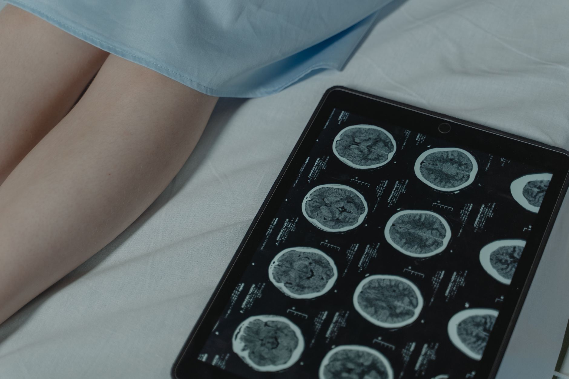 Close-up of a tablet displaying brain imaging scans beside a patient's legs in a clinic.