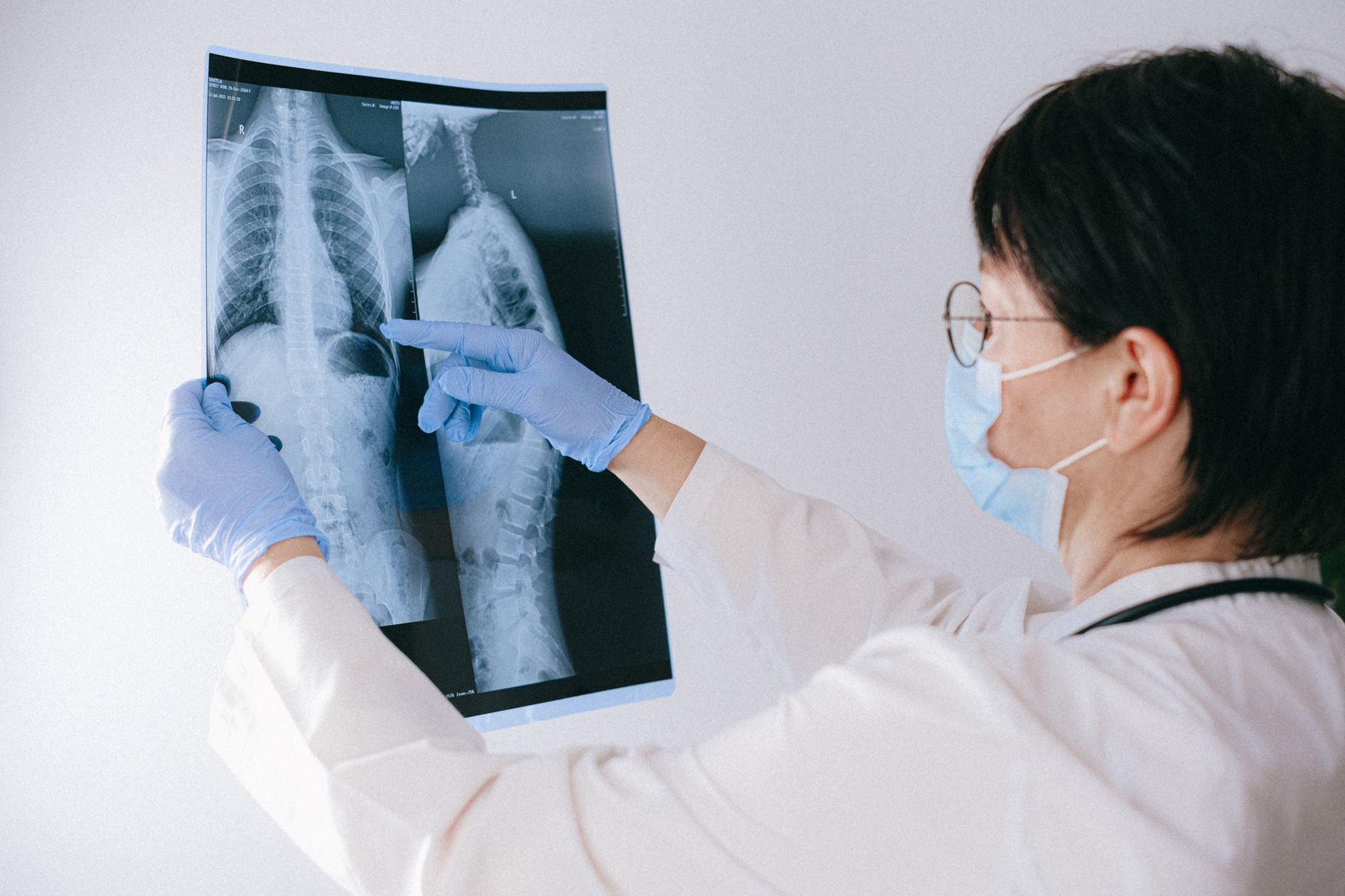A spine specialist in a white coat examines an X-ray of the back, pointing at details.
