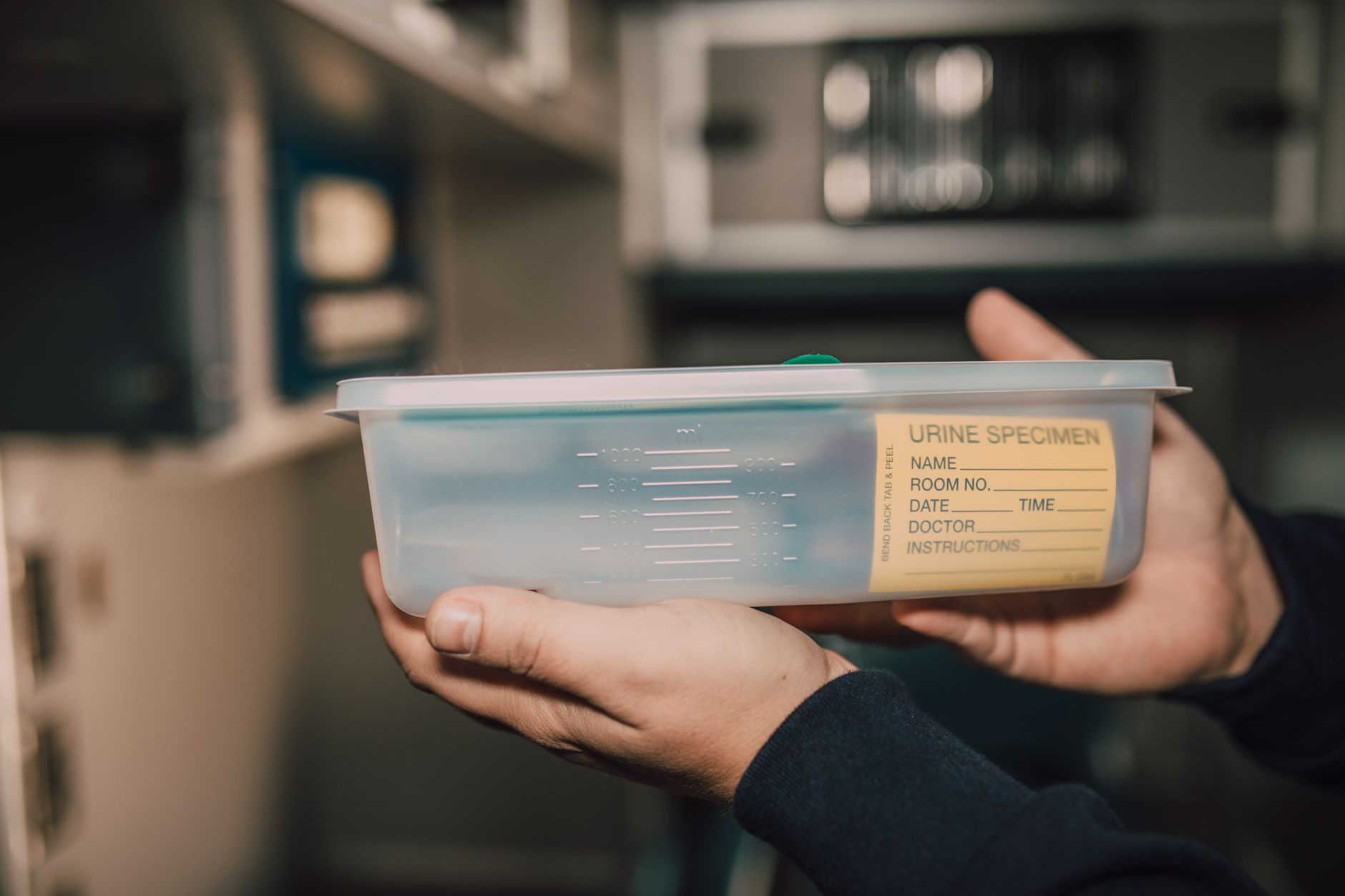 A technician holding a urine specimen container labeled for collection in a laboratory setting.