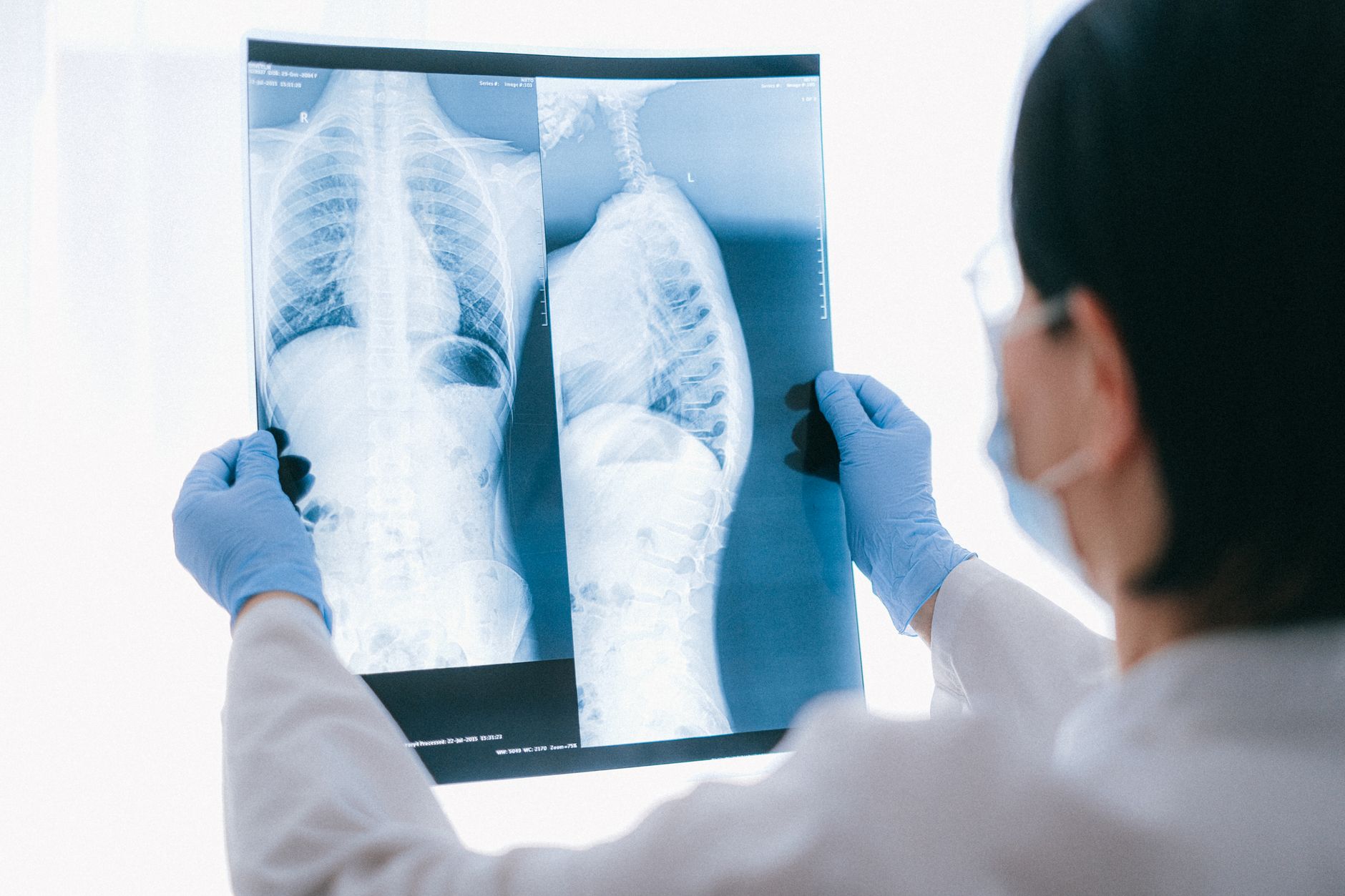 A doctor in a white coat examines a child's back X-ray in a modern clinic.