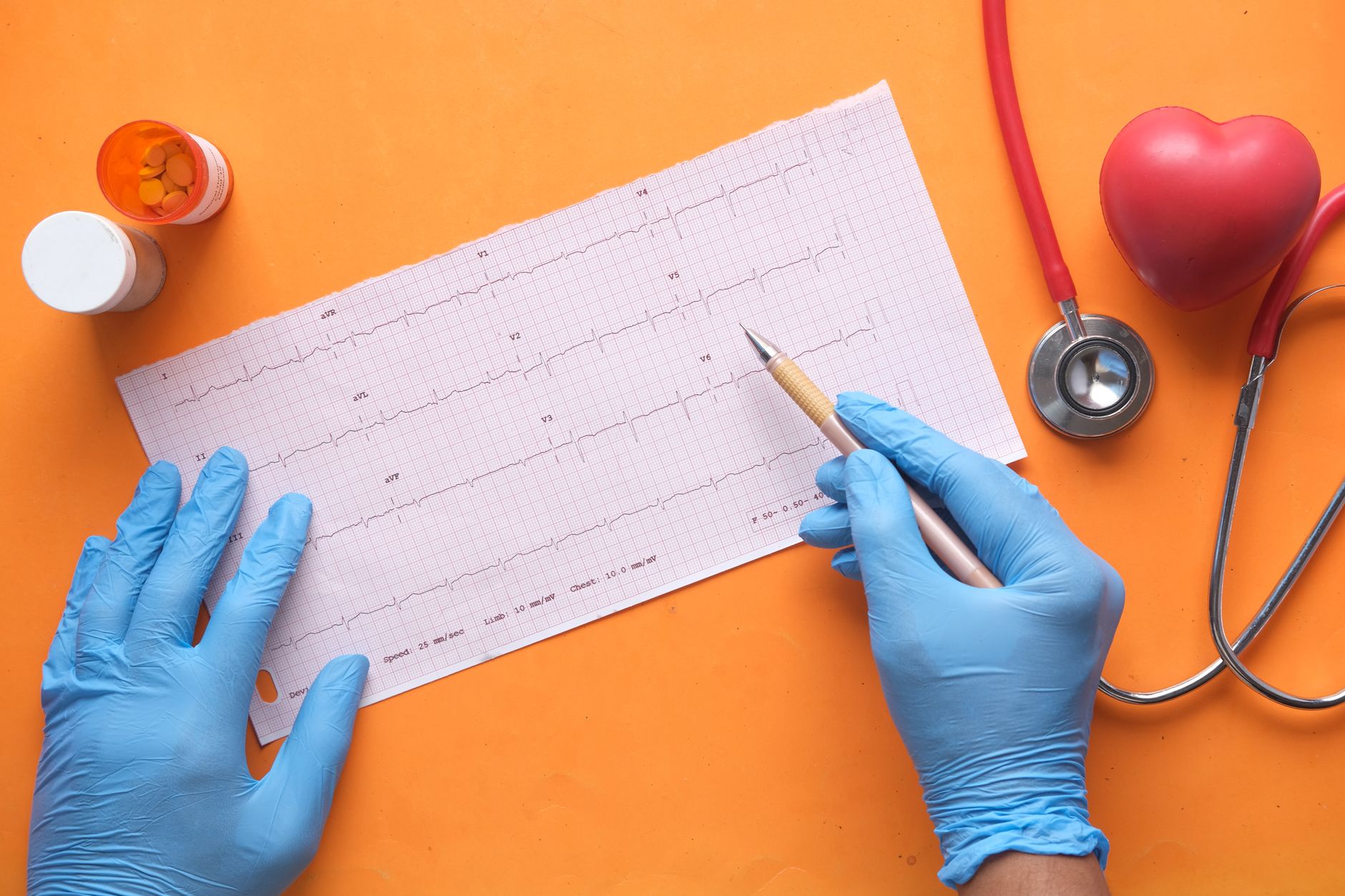 Close-up of hands analyzing an ECG printout with a stethoscope, pills, and a medical setting.